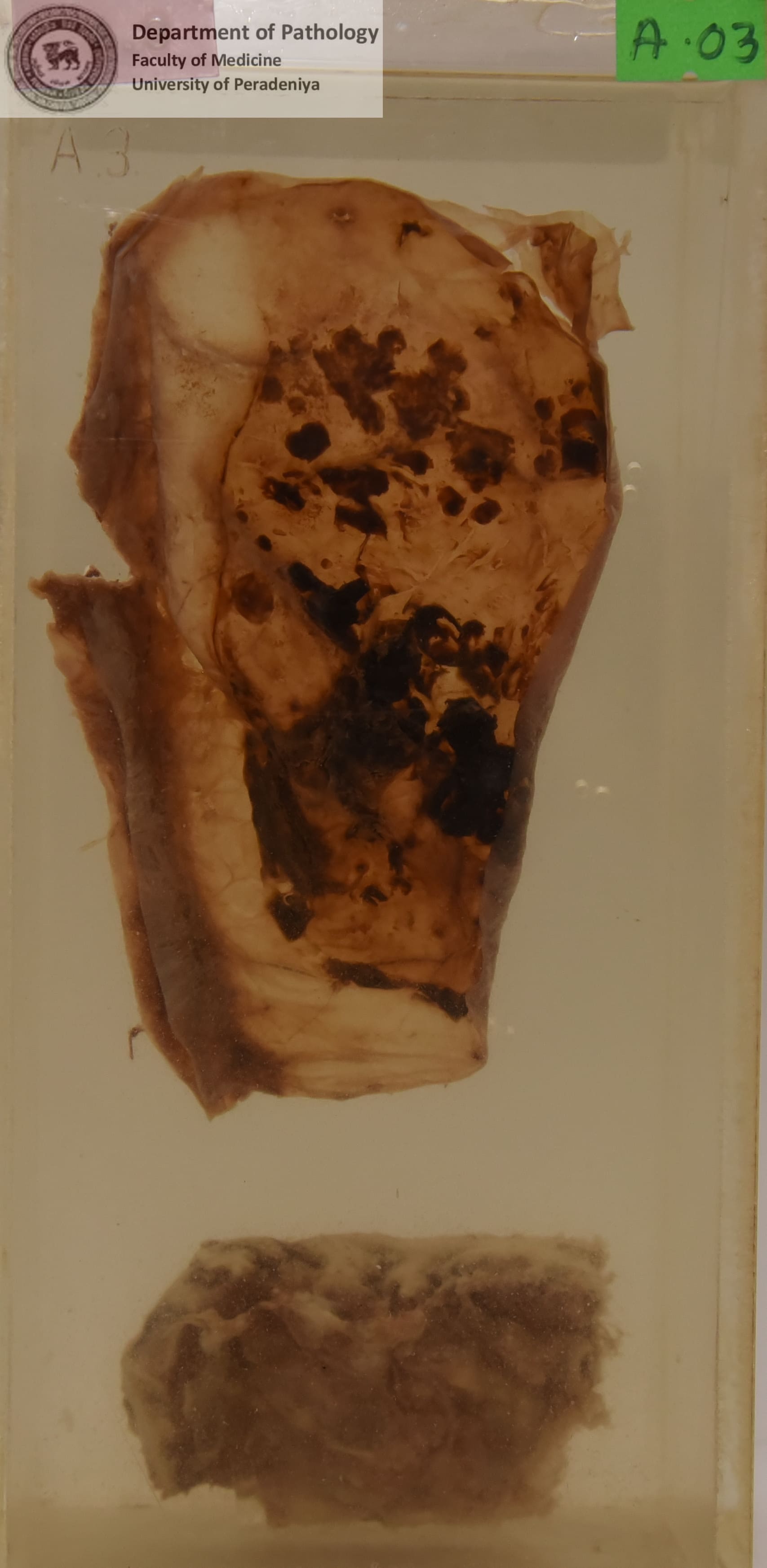 A.3