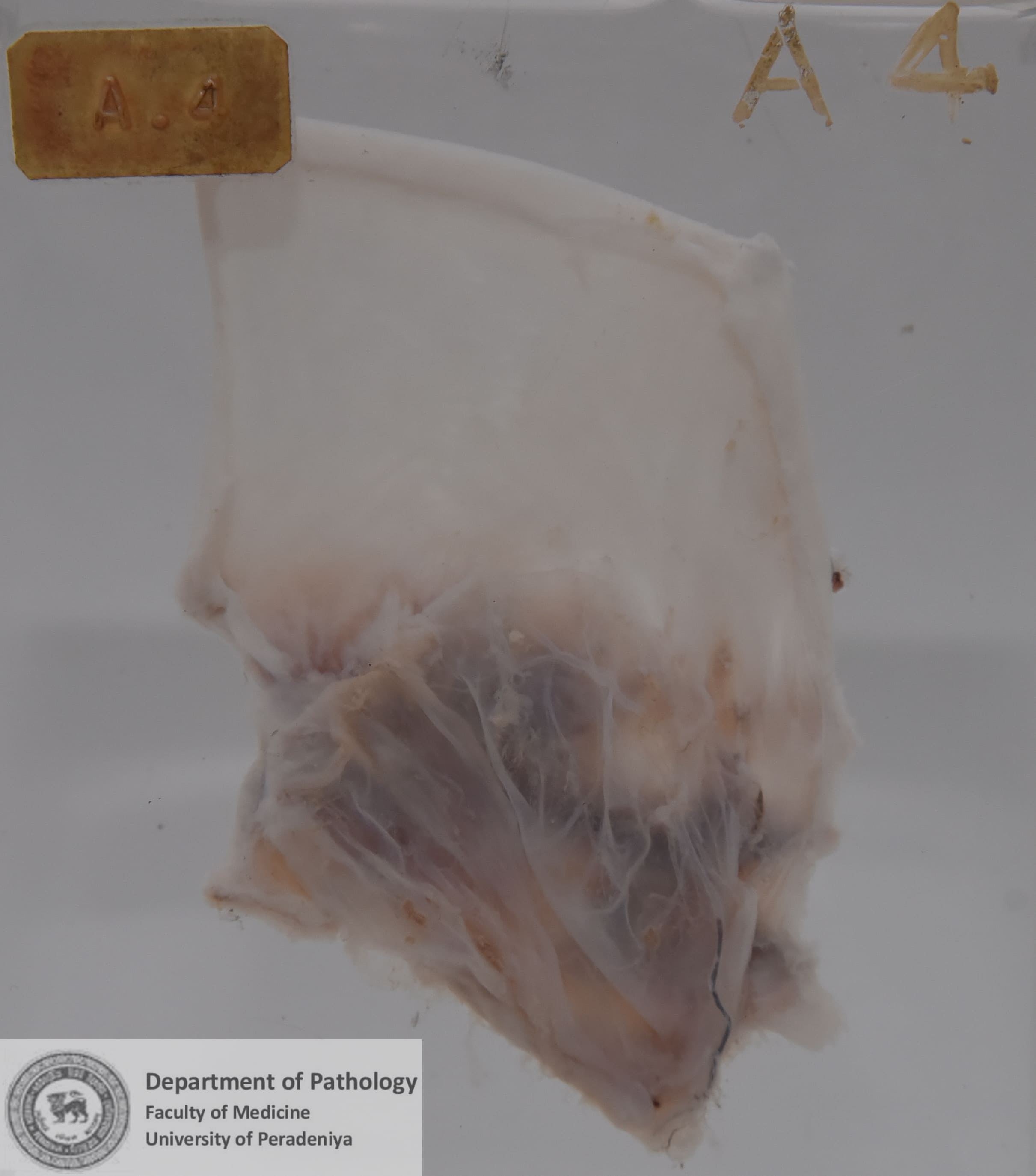 A.4