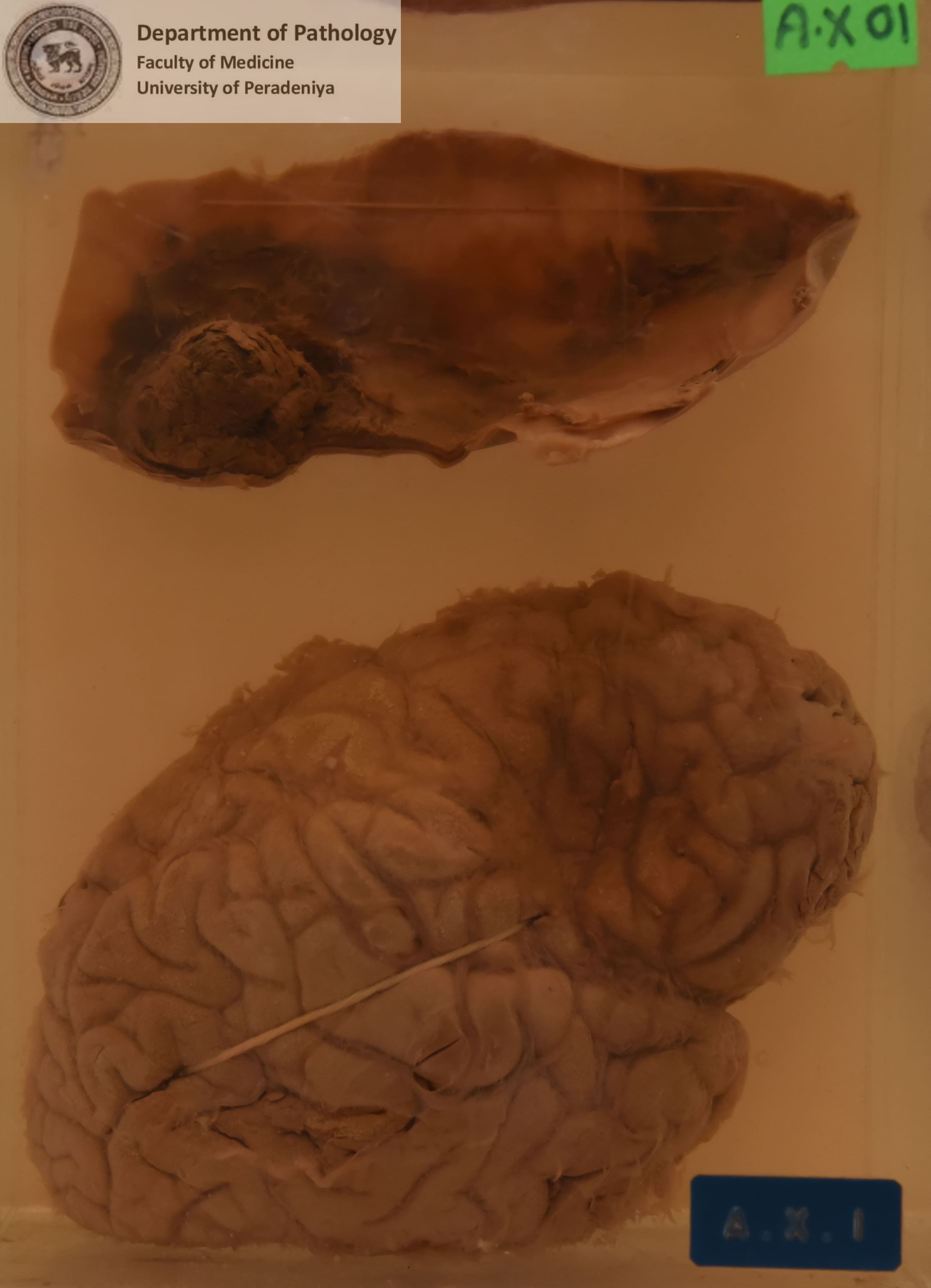 AX.1