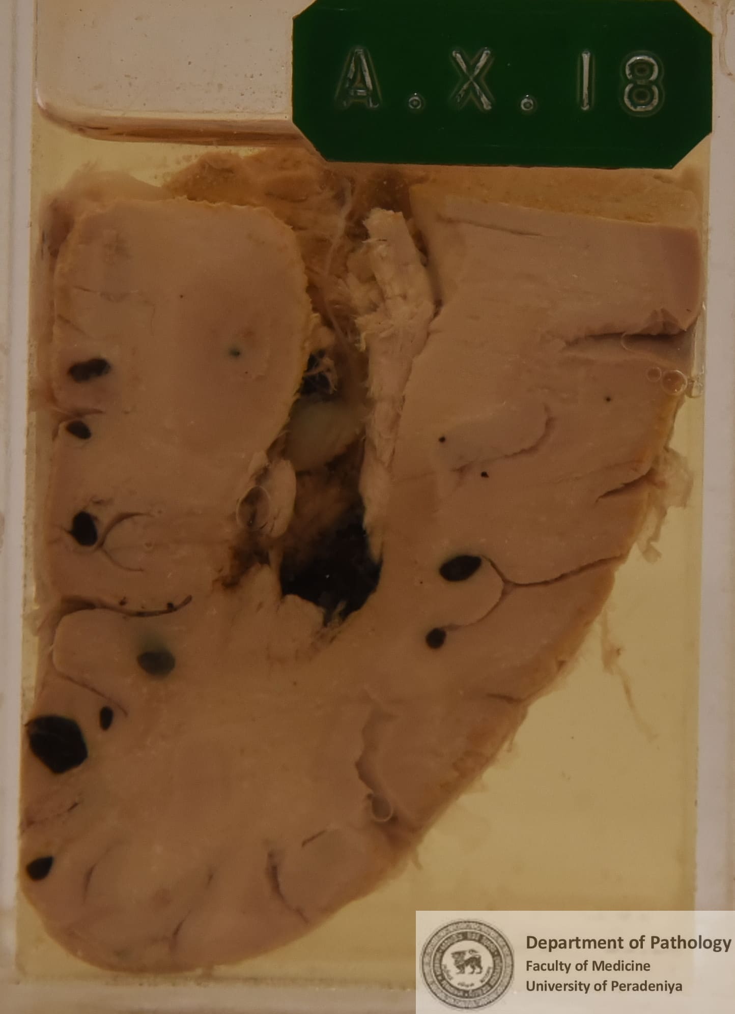 AX.18