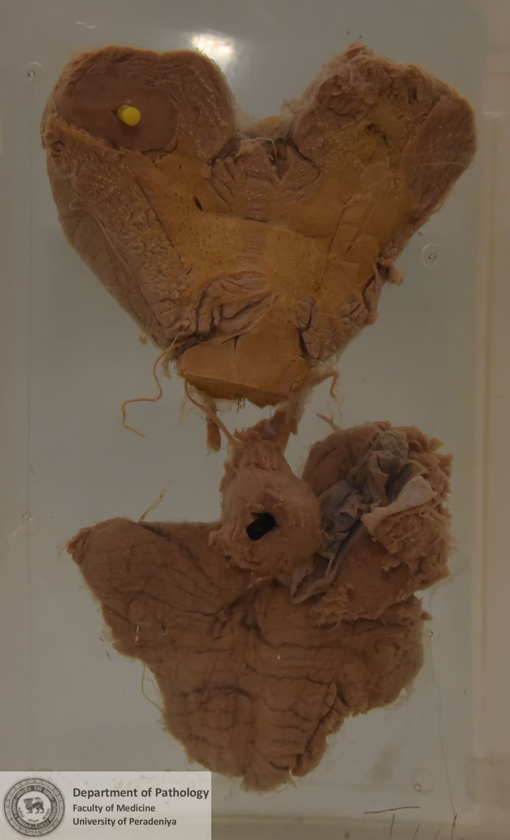 AX.23