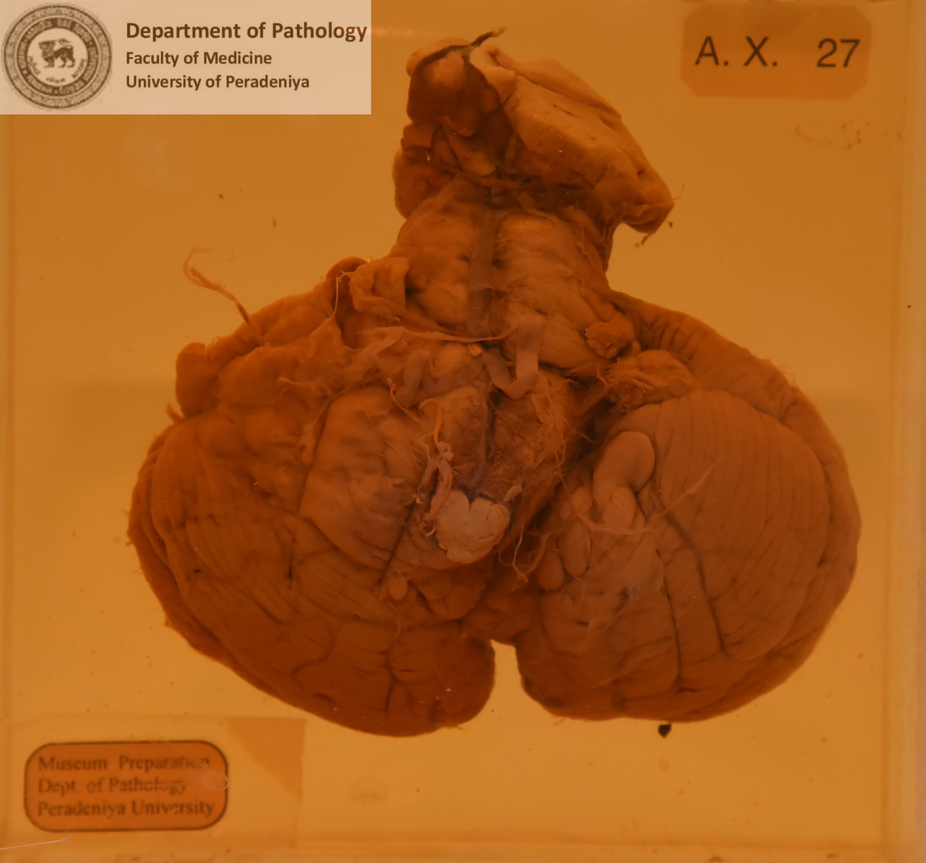 AX.27