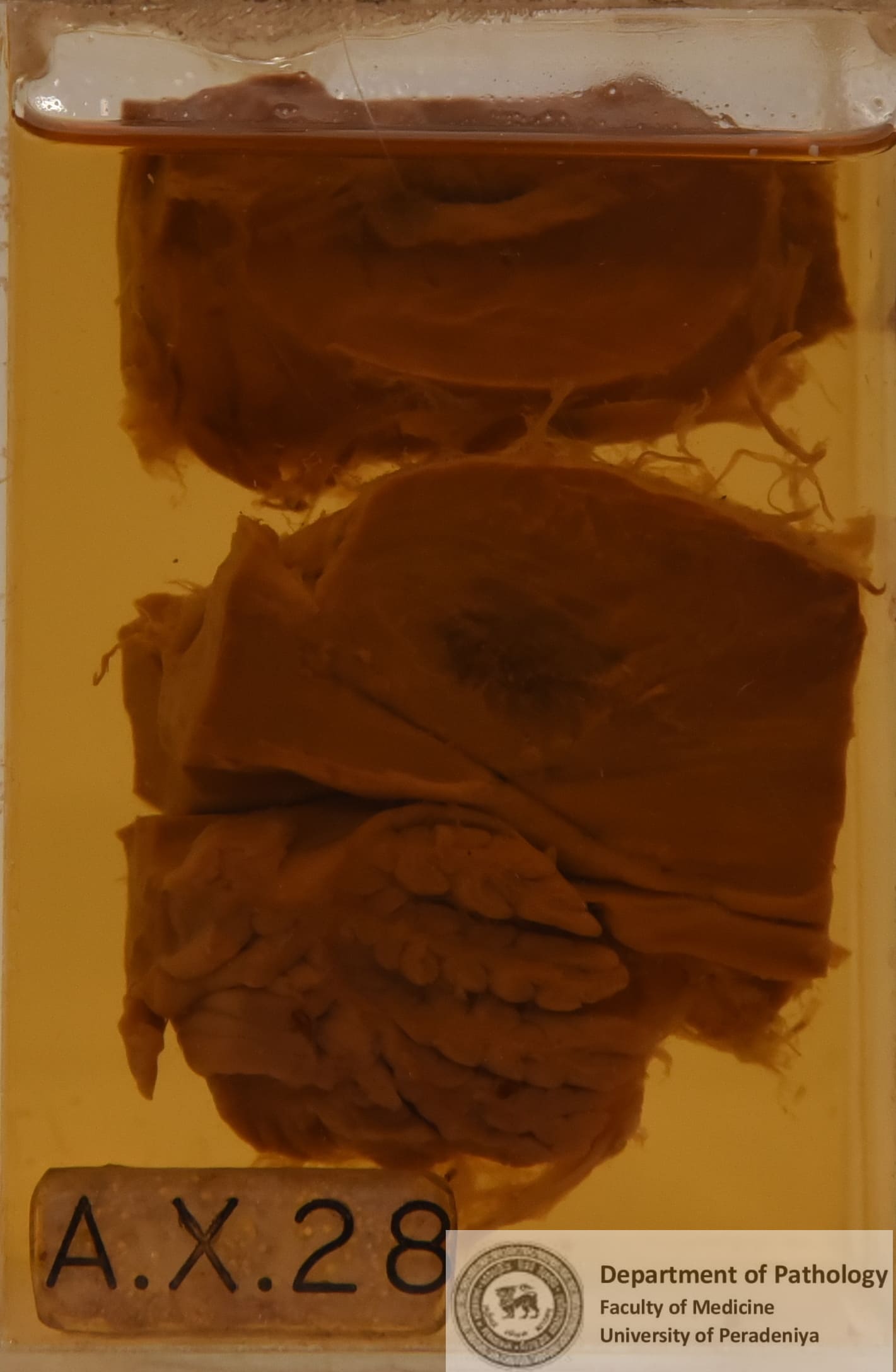 AX.28
