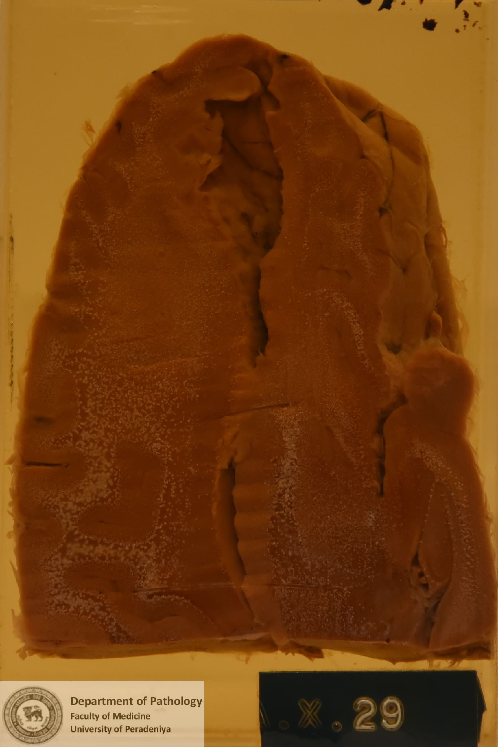 AX.29