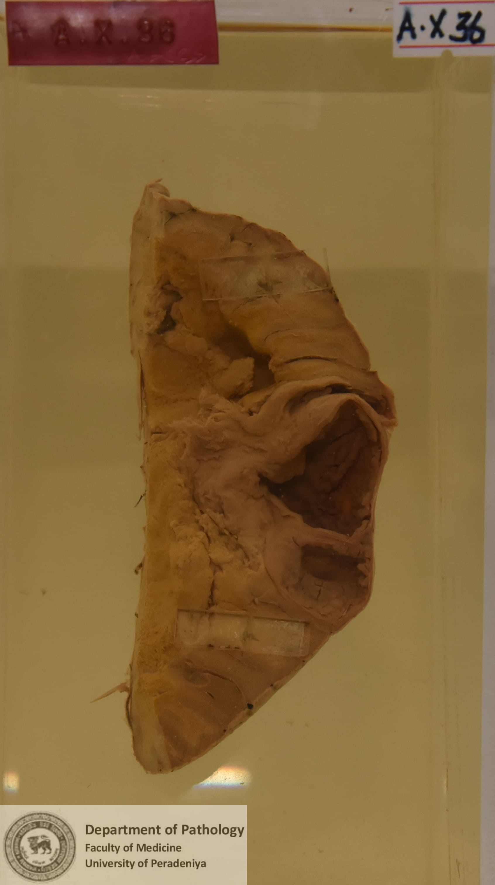 AX.36