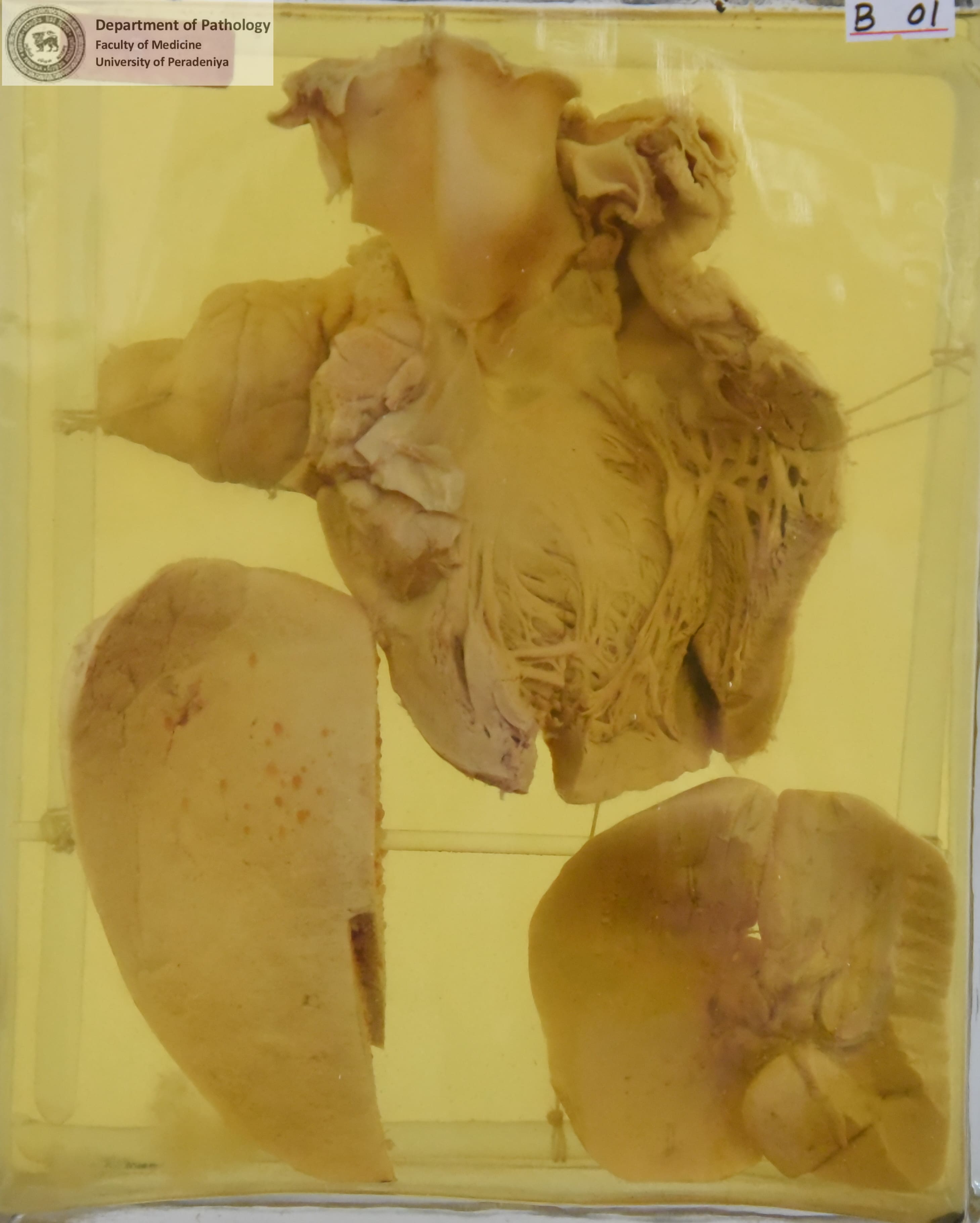 B.1