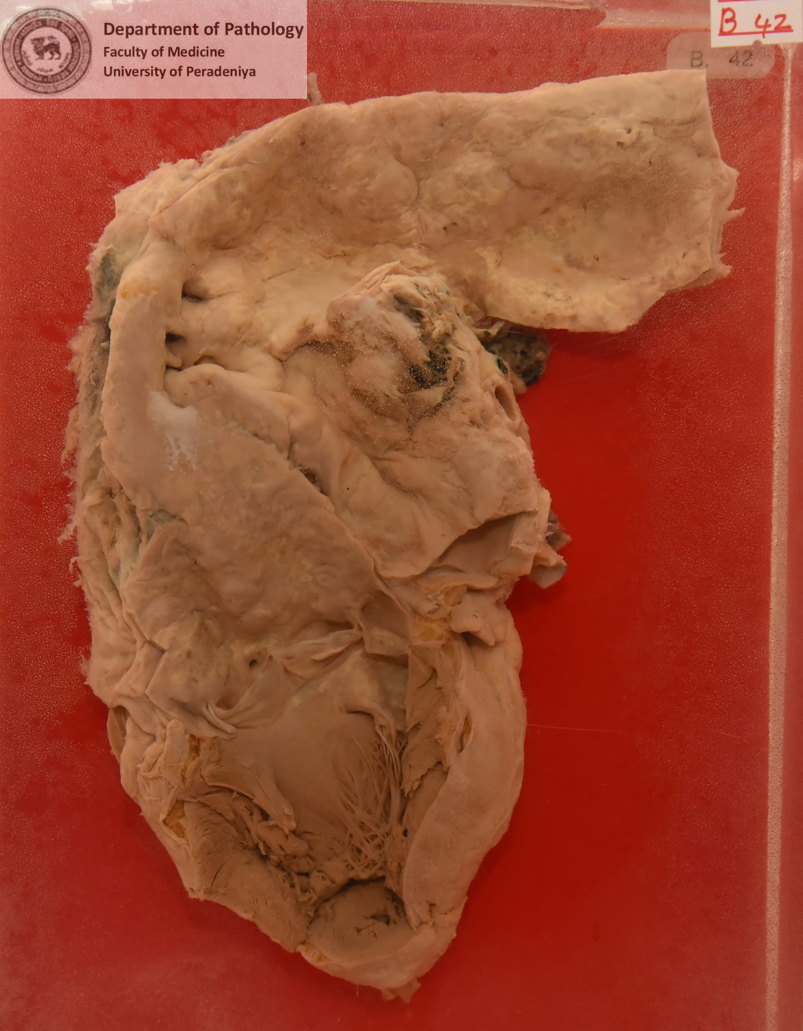 B.42