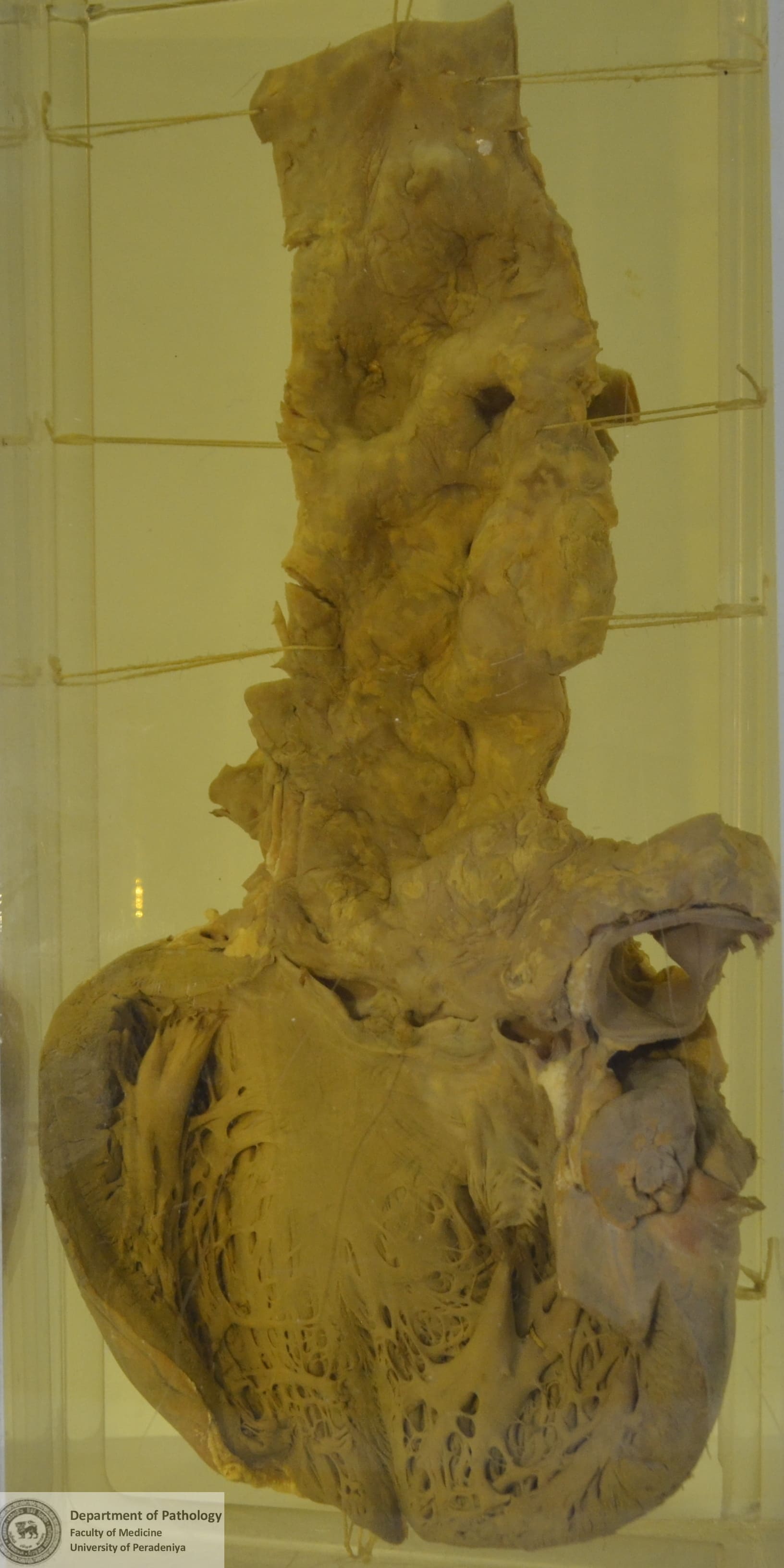 B.141