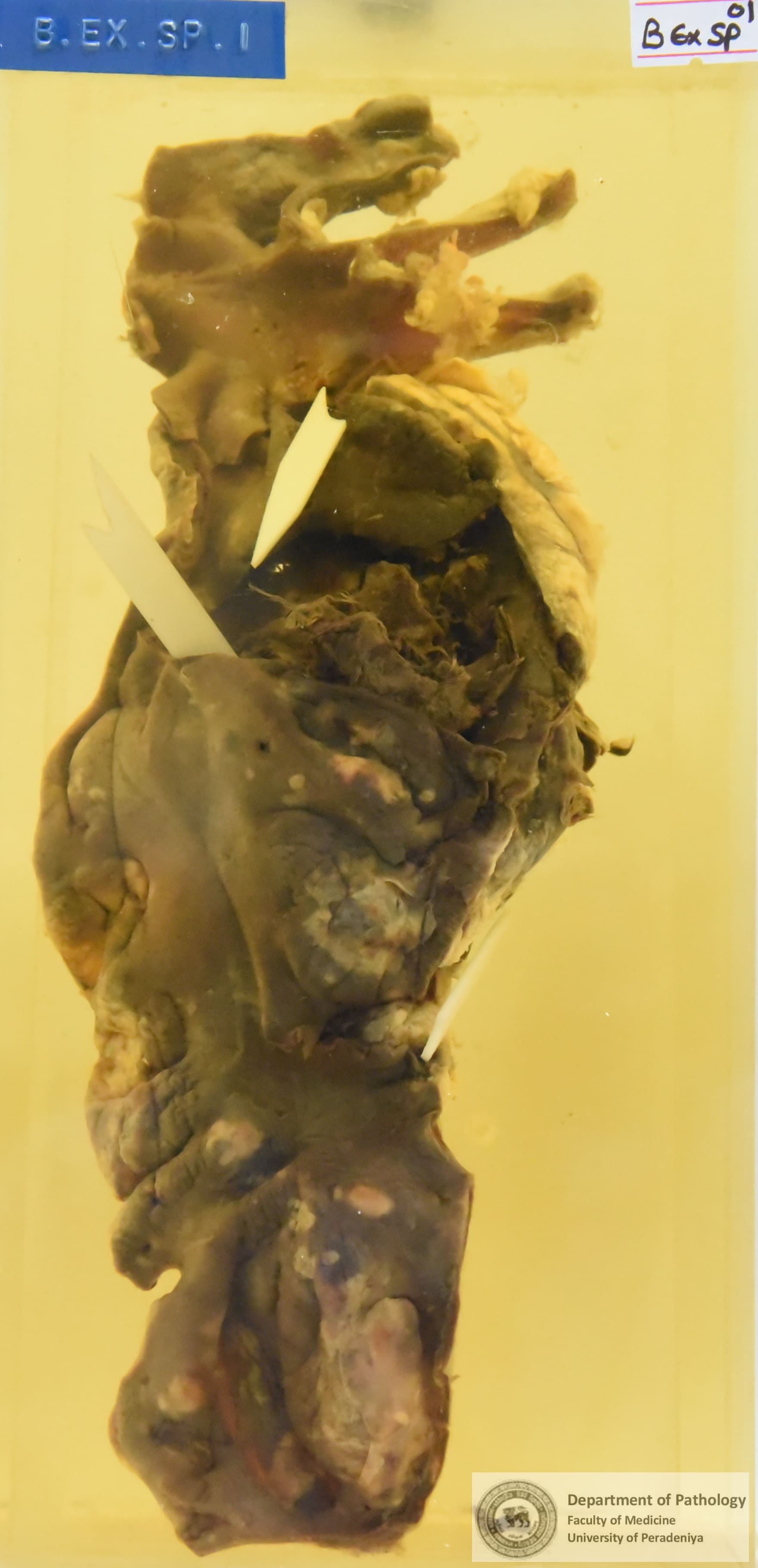 B.Ex.Sp.1