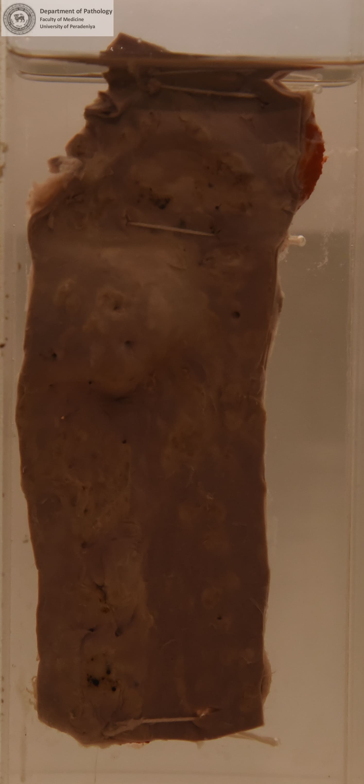 BX.6