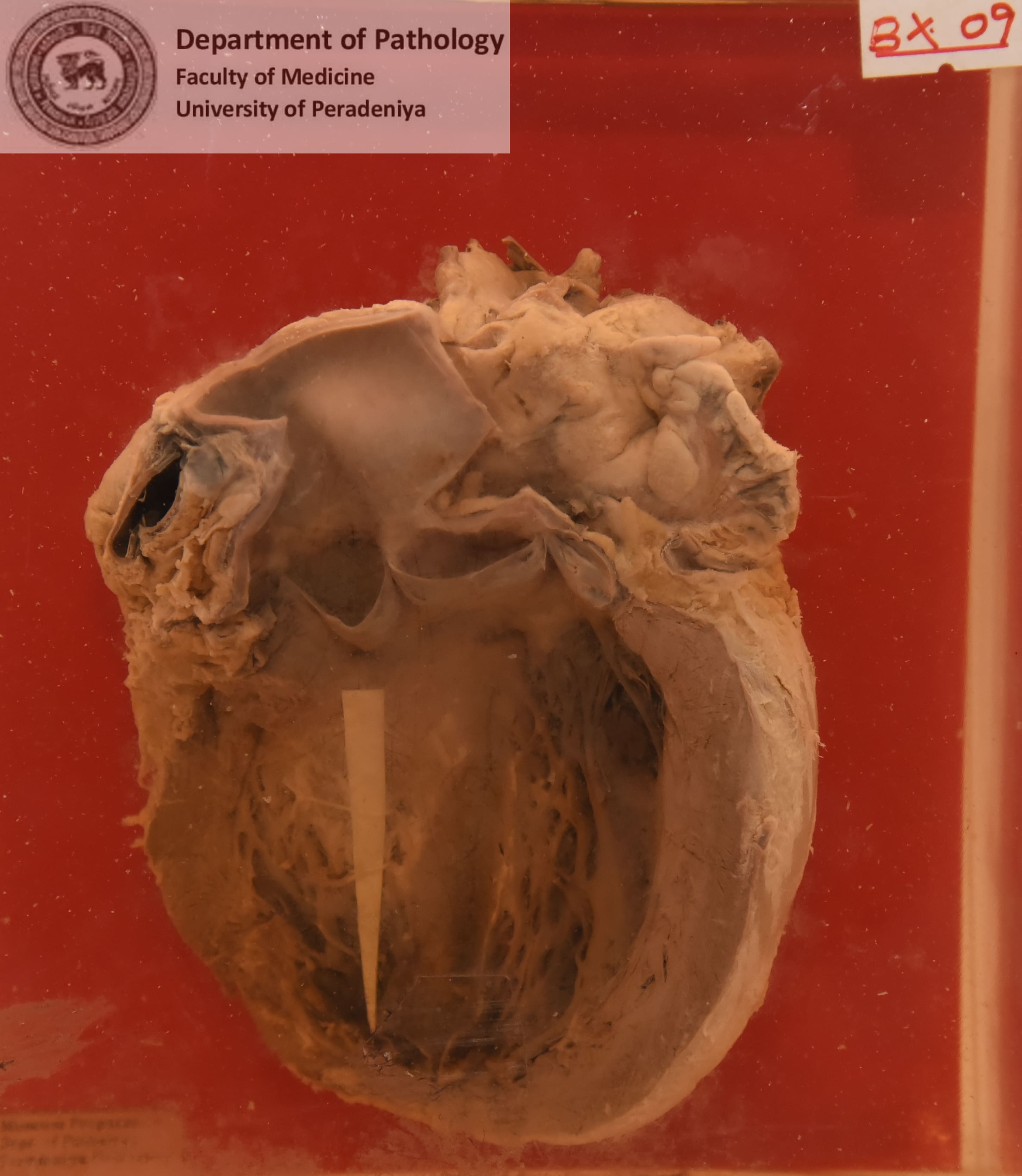 BX.9