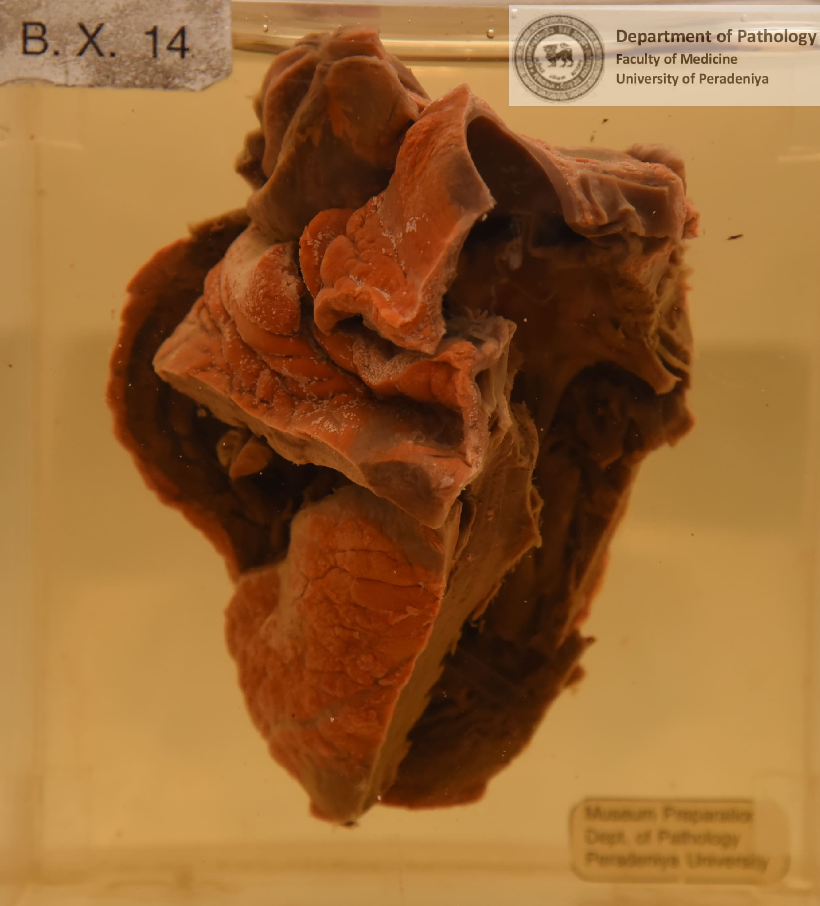 BX.14