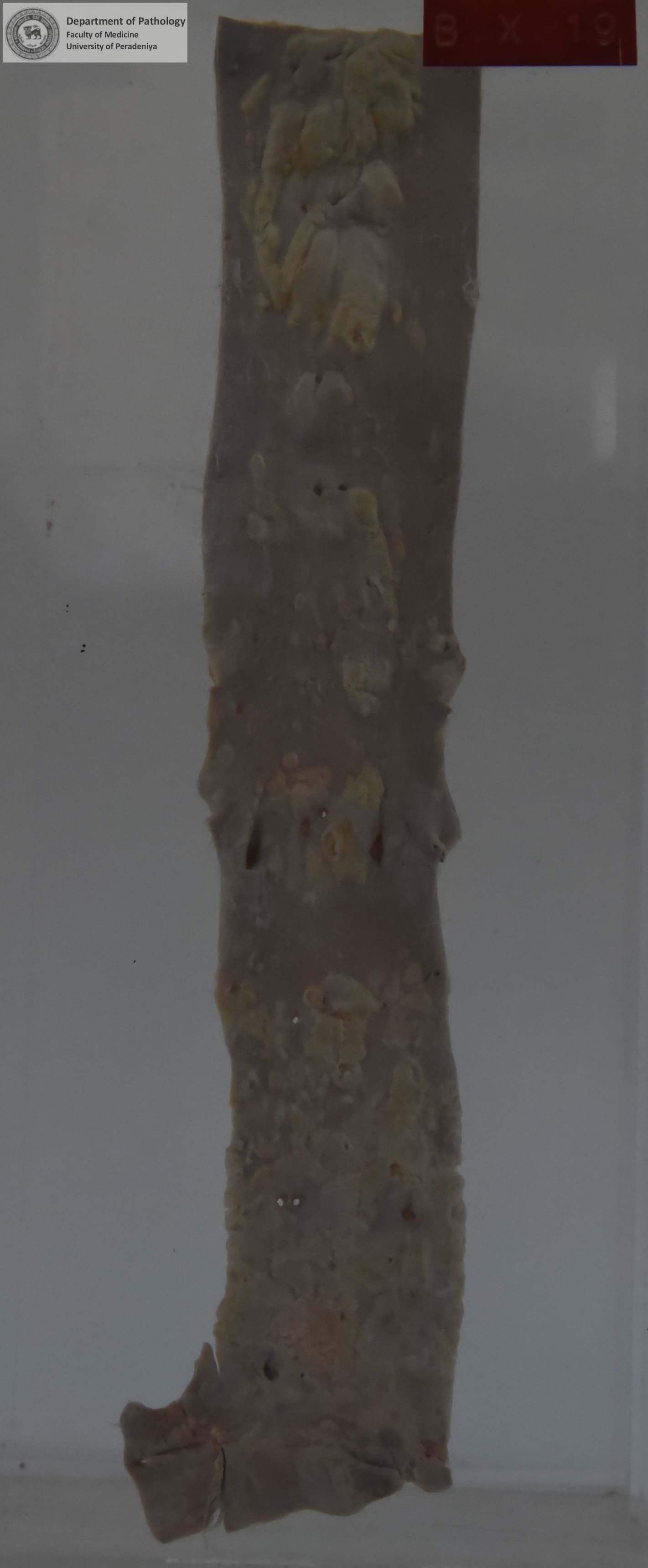 BX.19