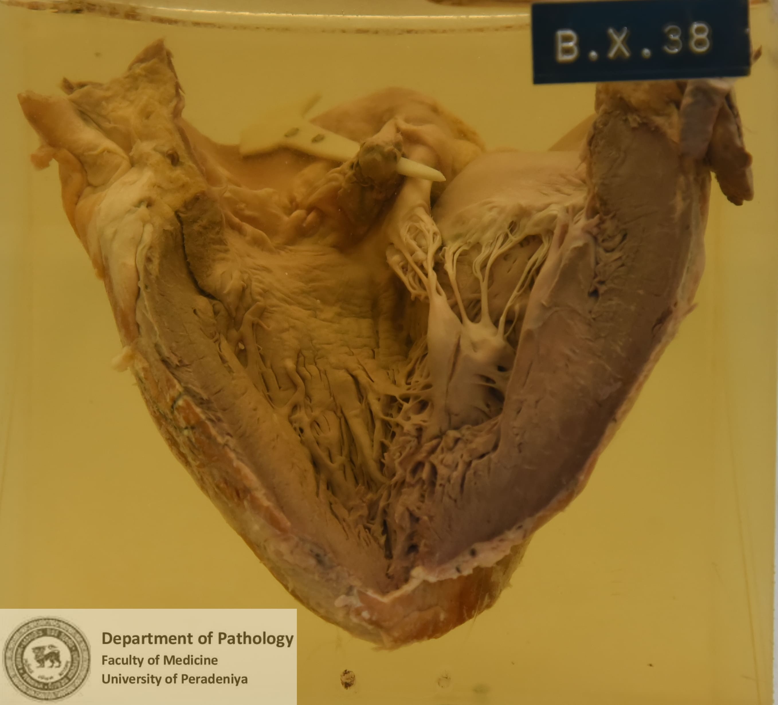 BX.38