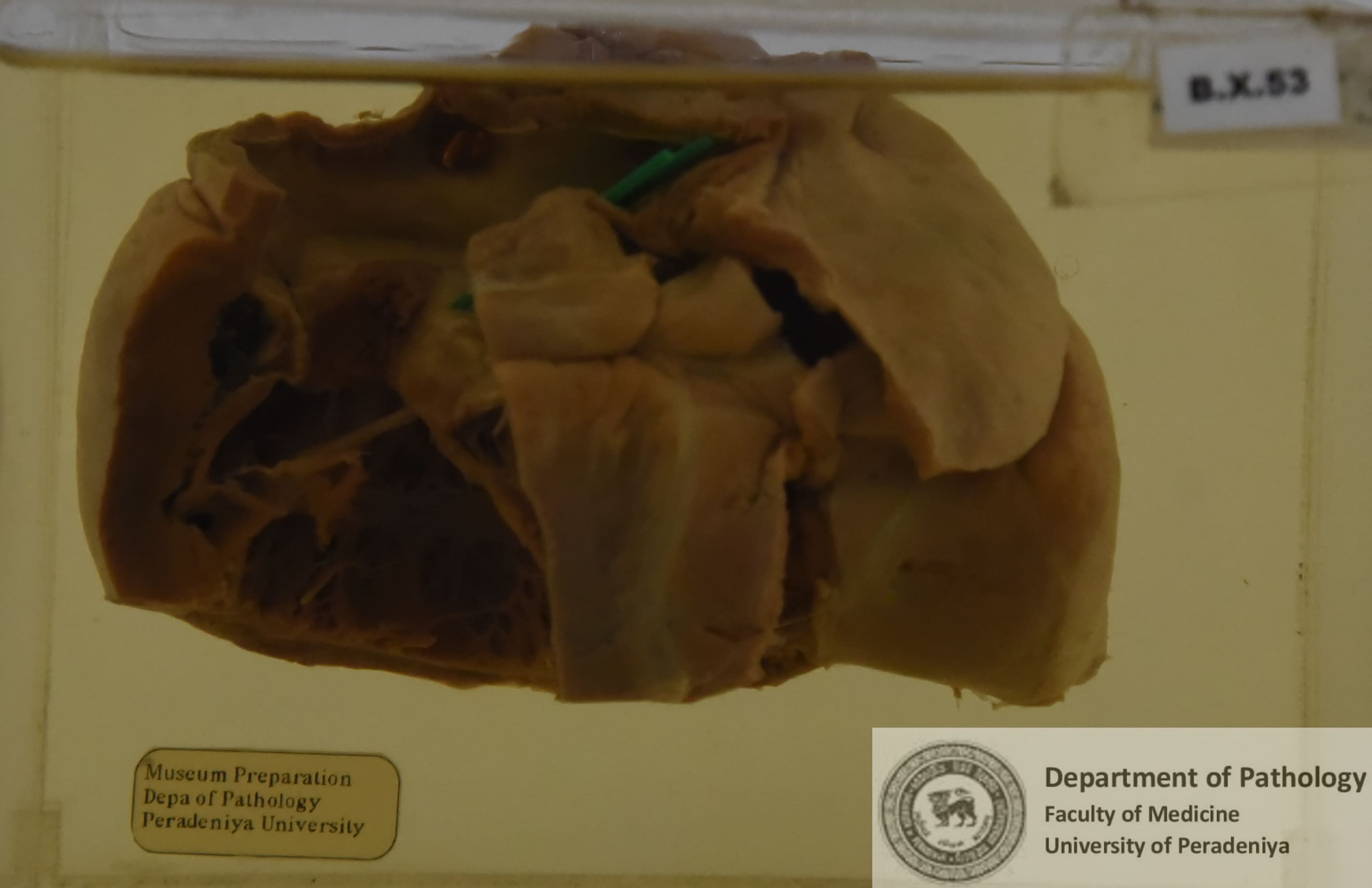 BX.53