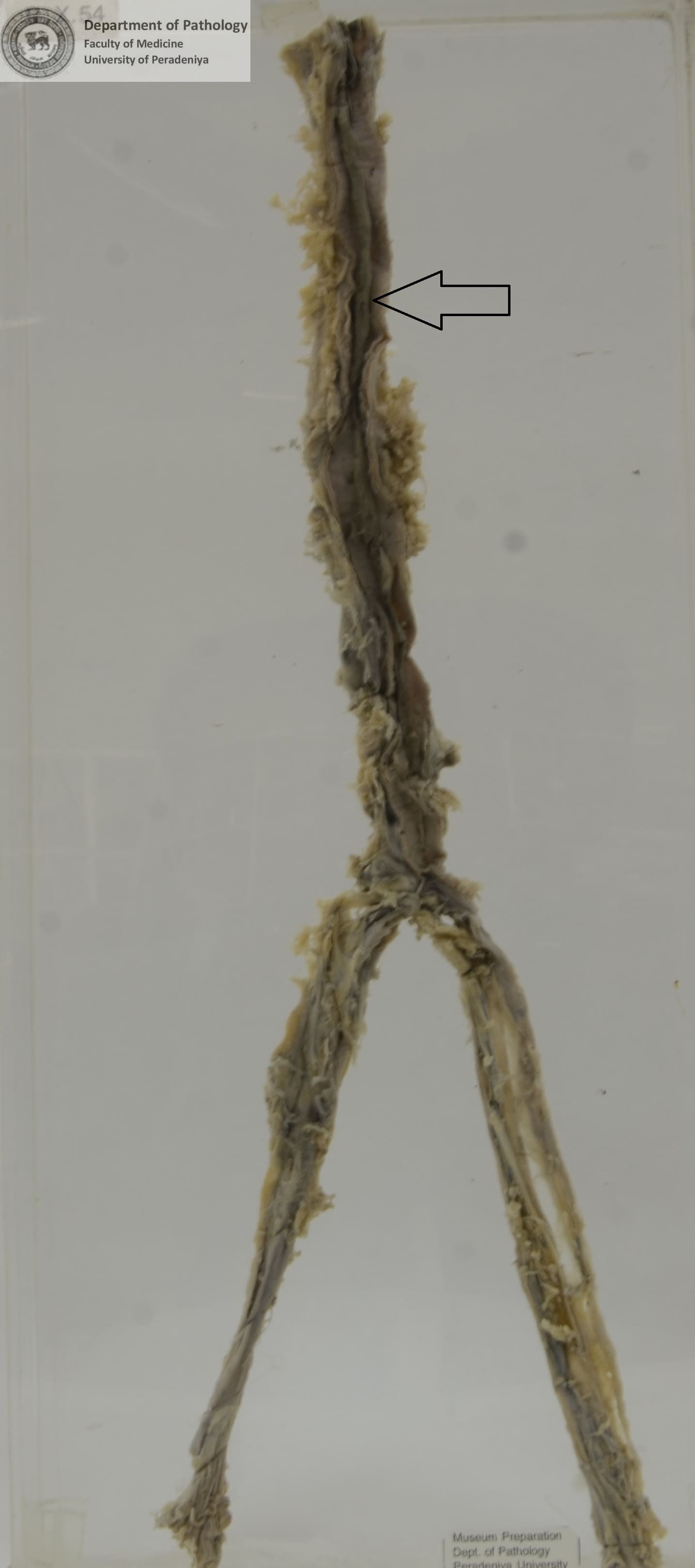 BX.54