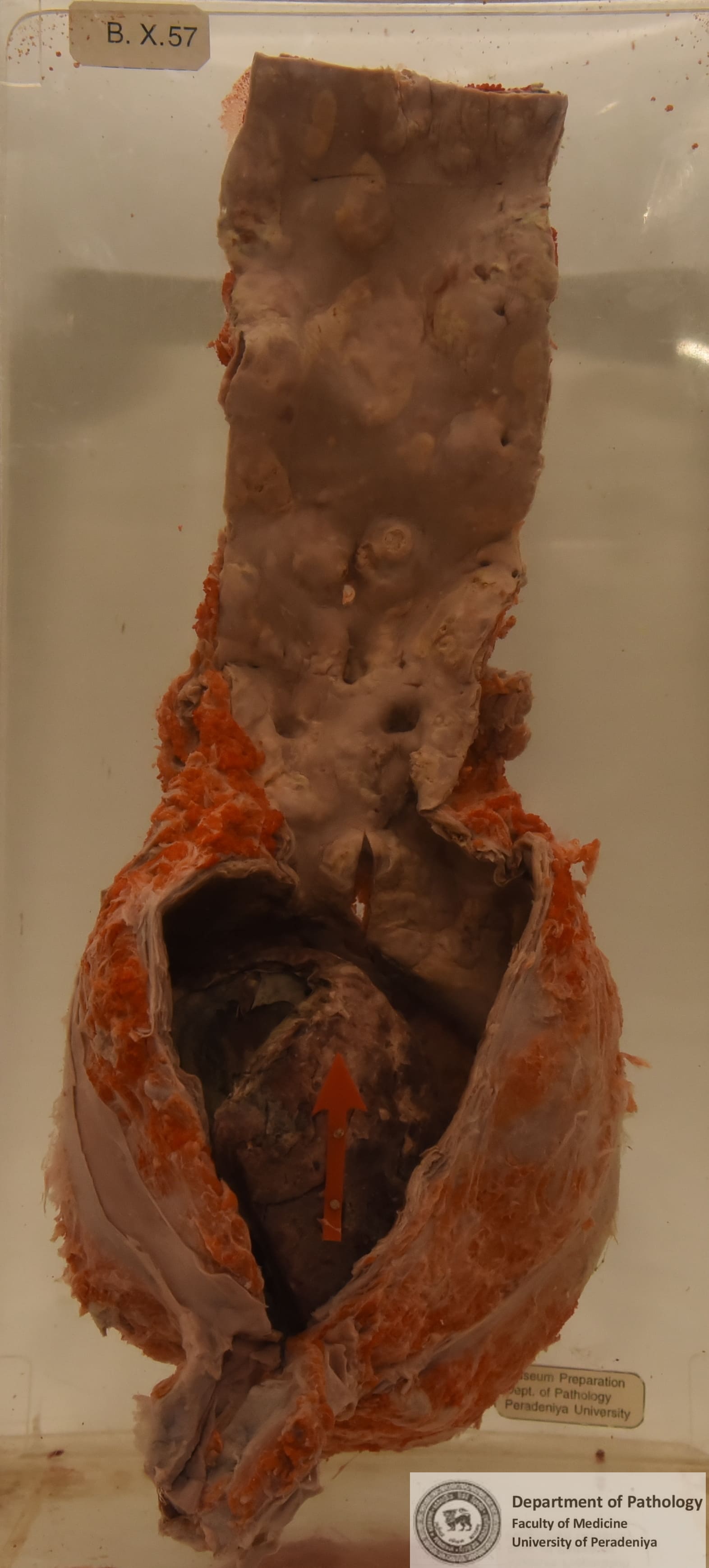 BX.57