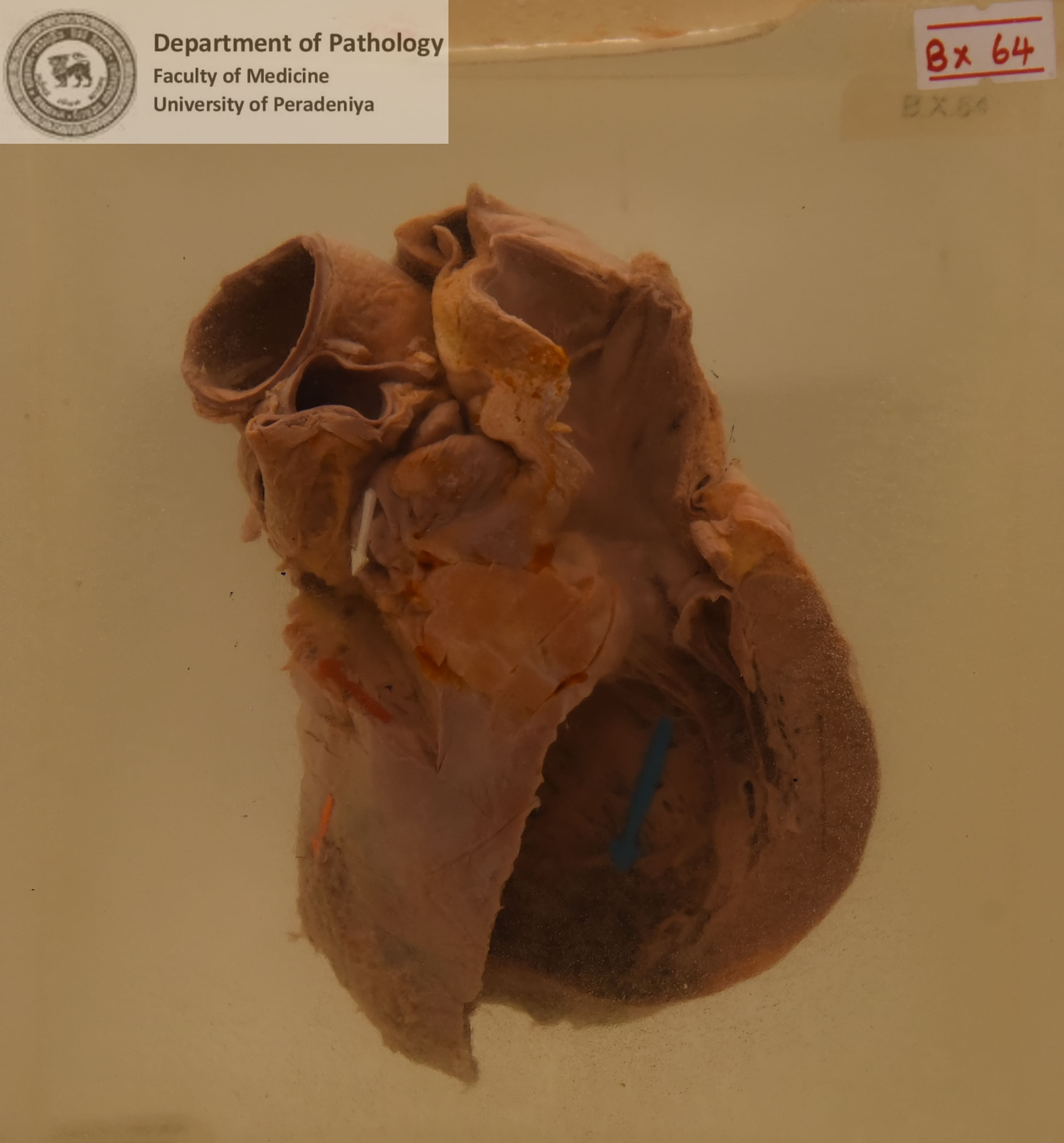 BX.64