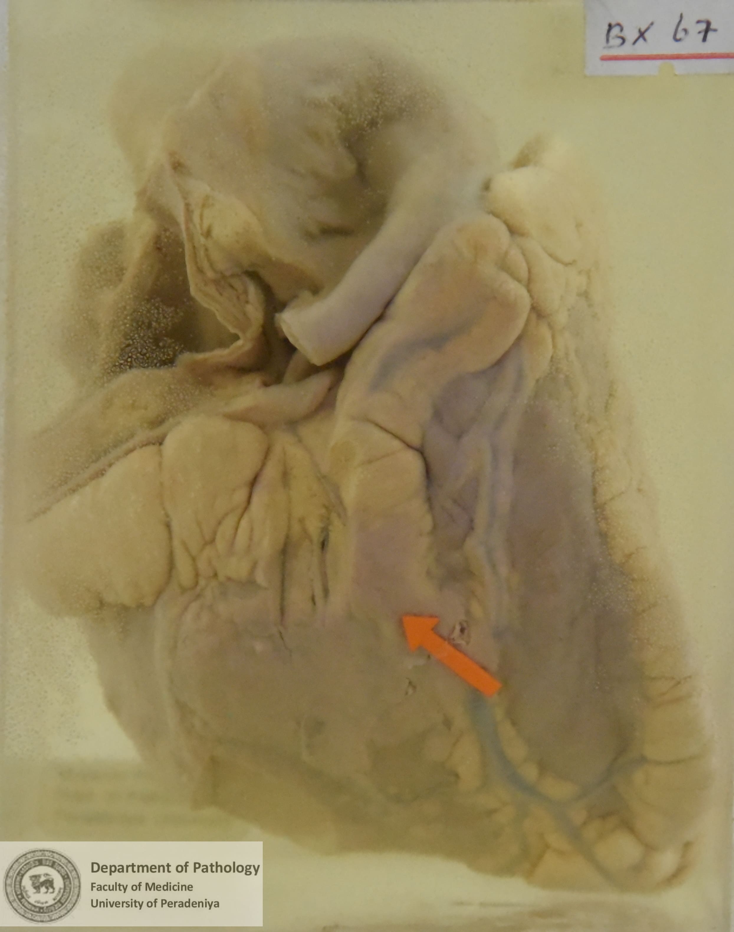 BX.67