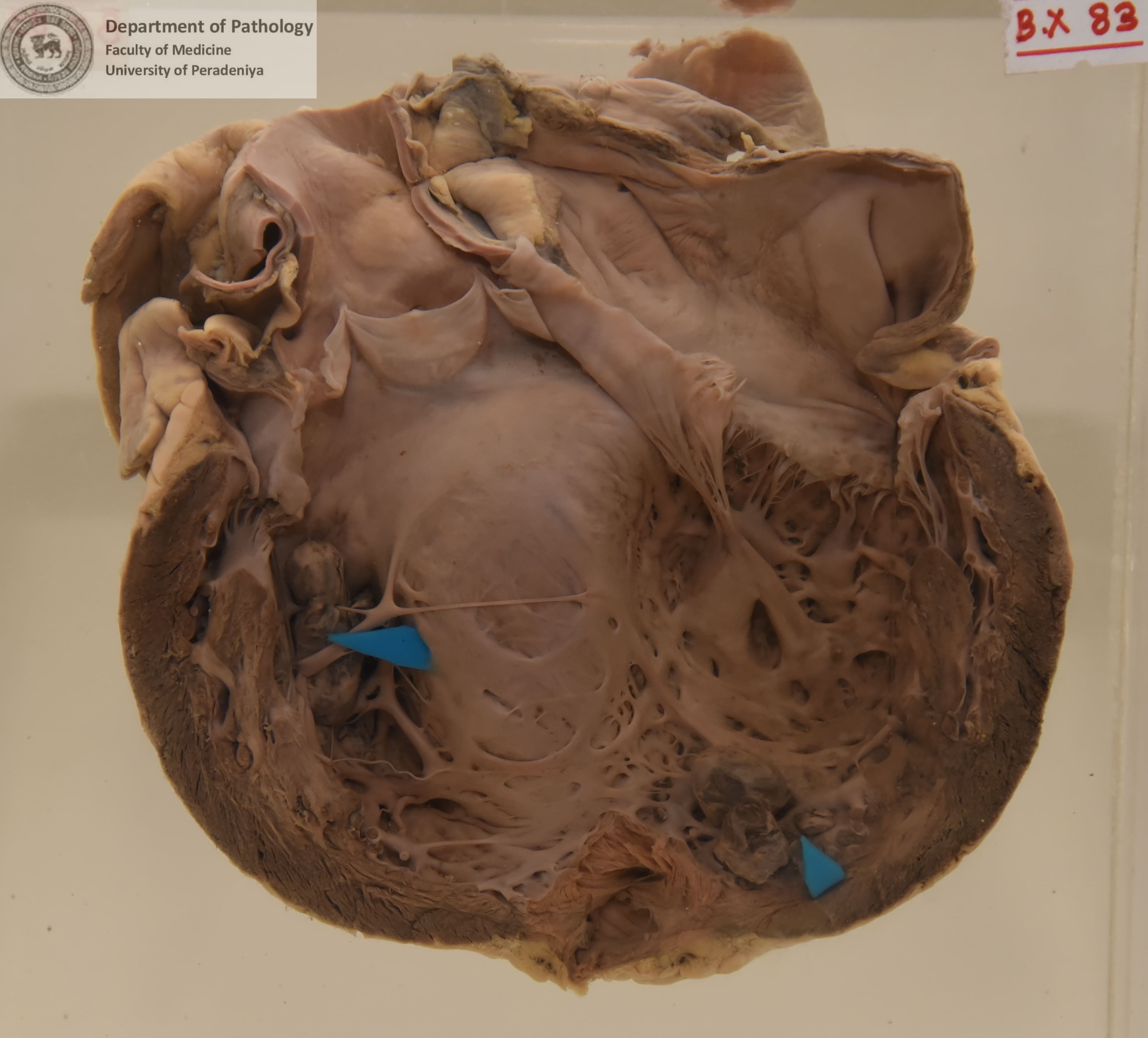 BX.83