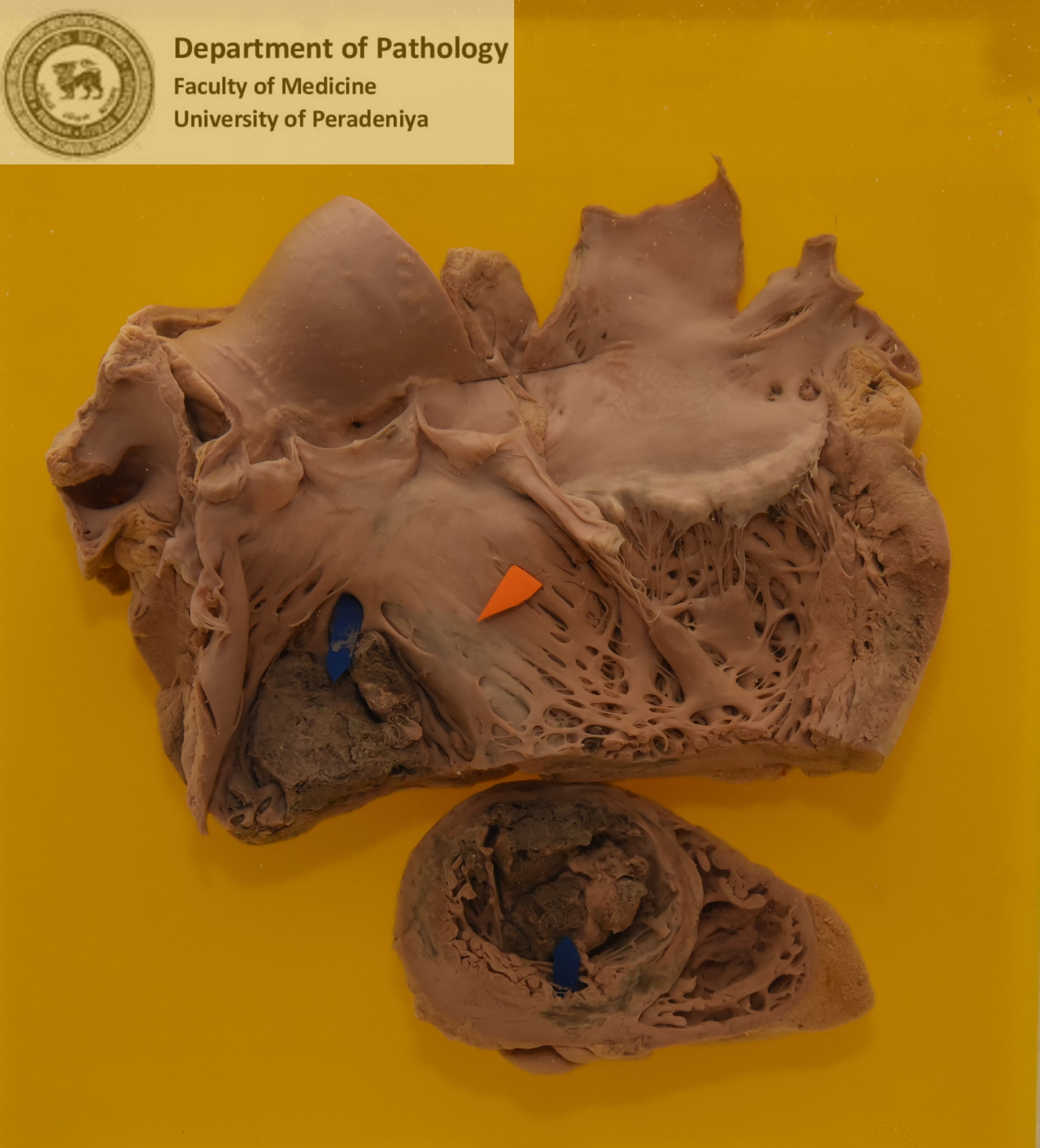 BX.90
