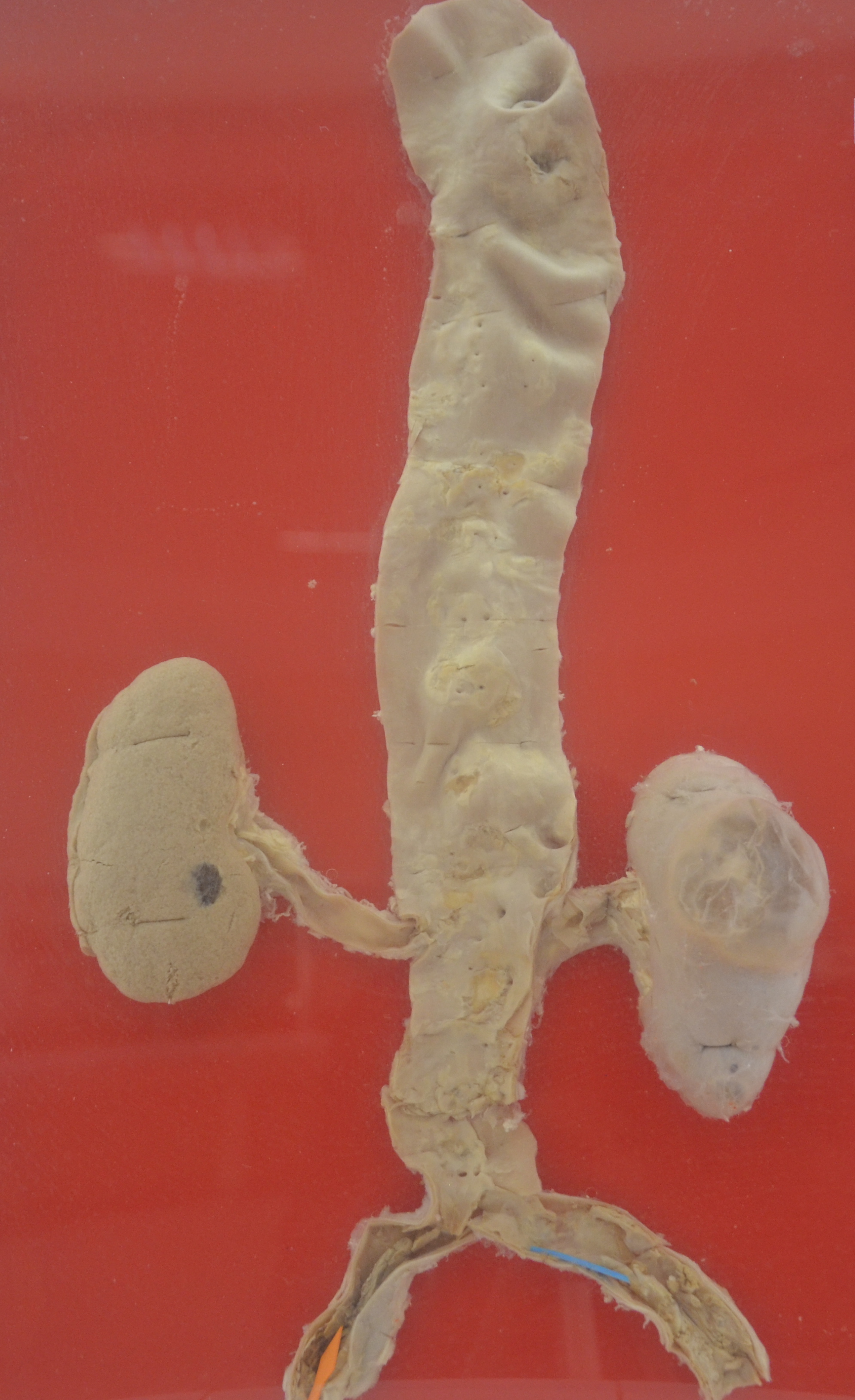 BX.59