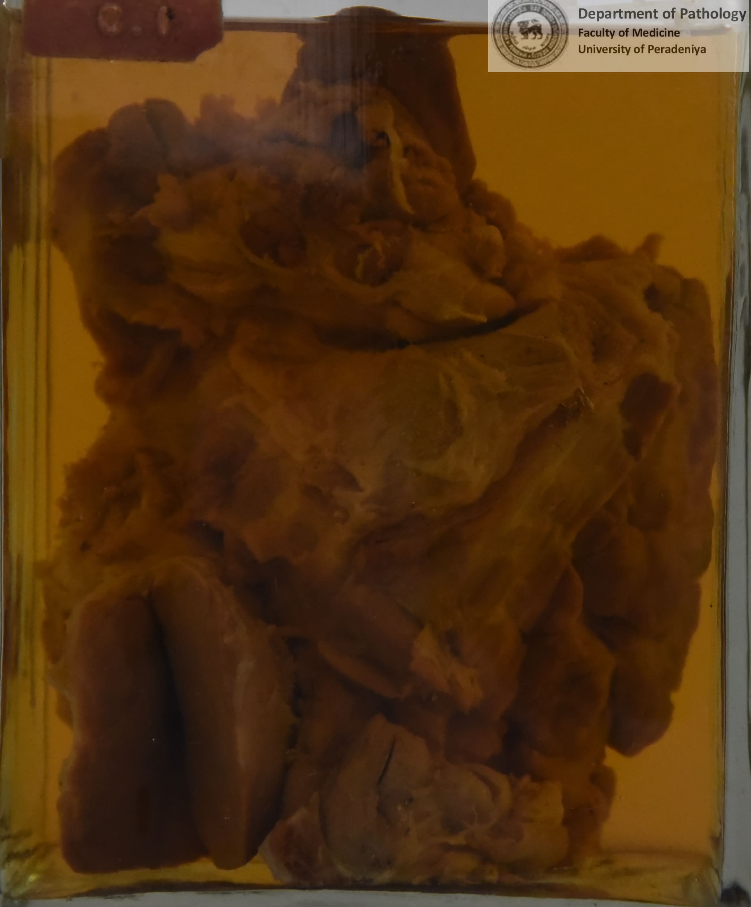 C.1