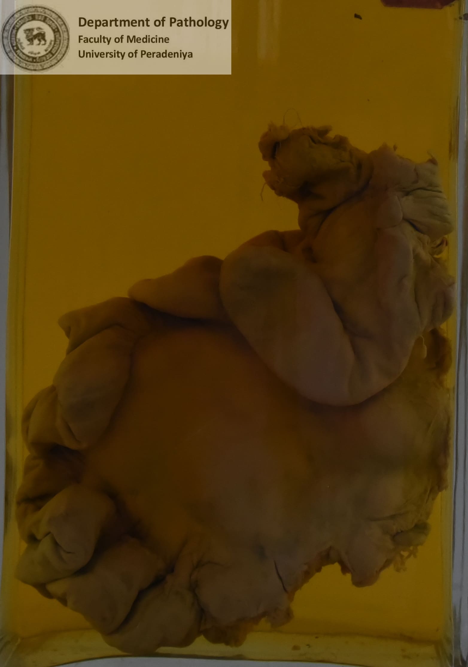 C.2