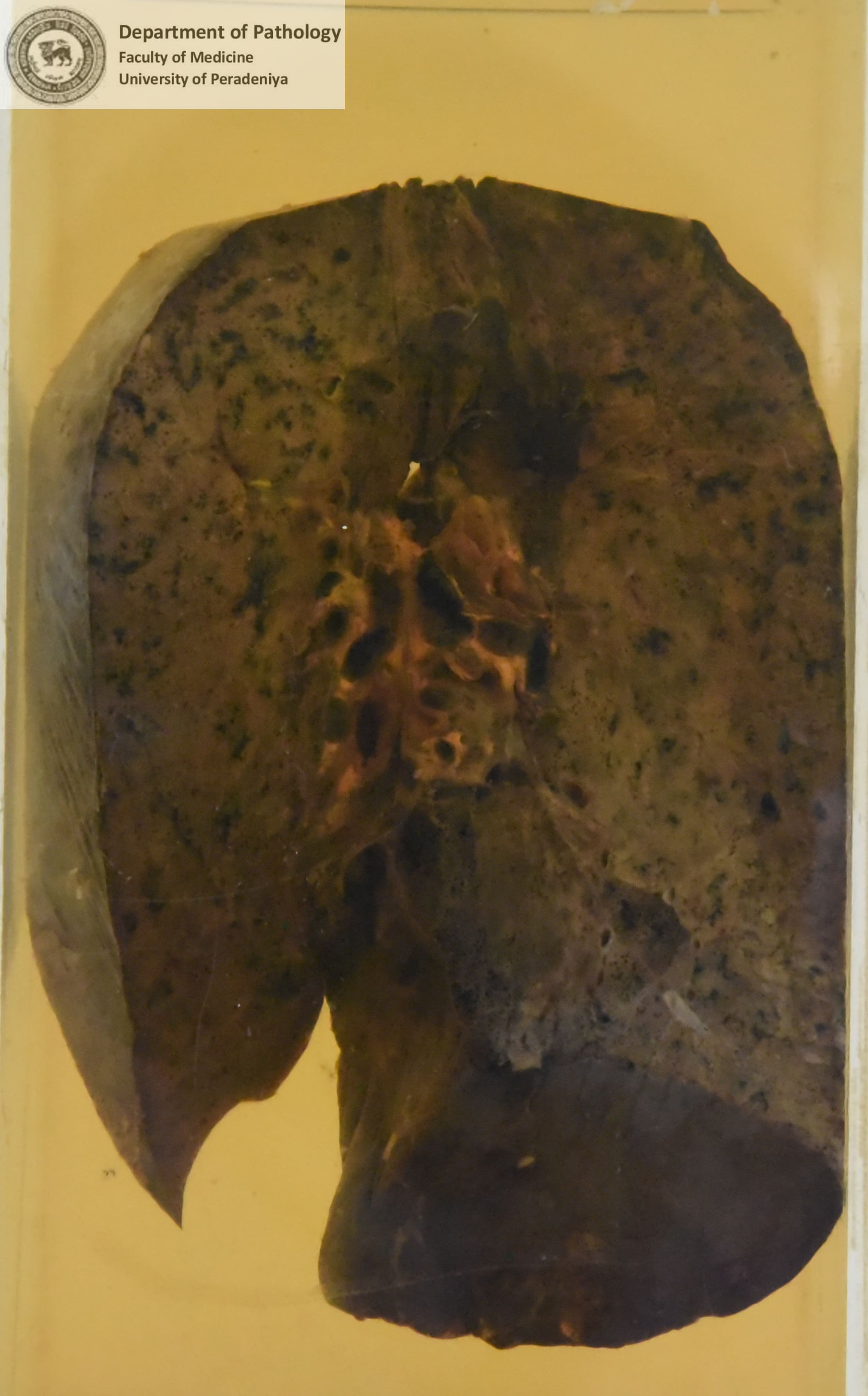 D.1