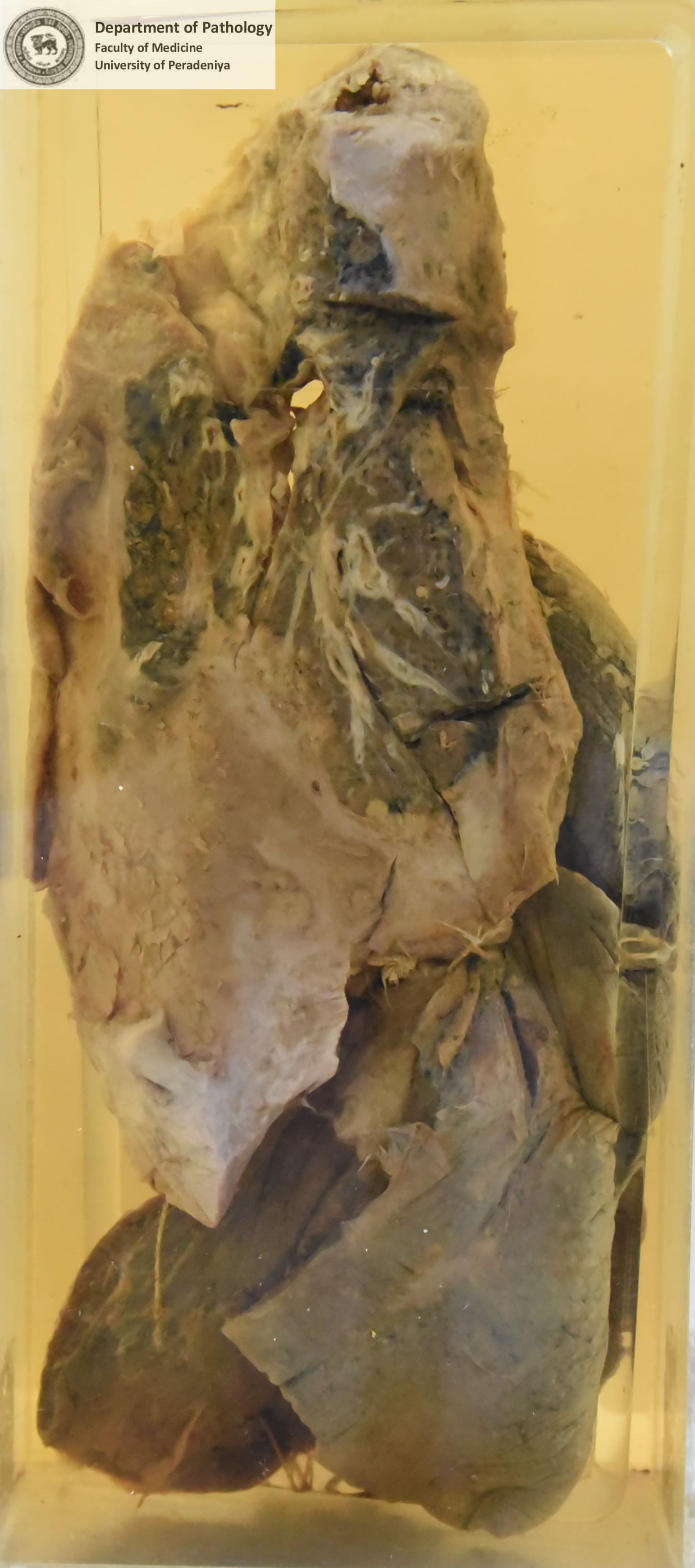 D.22
