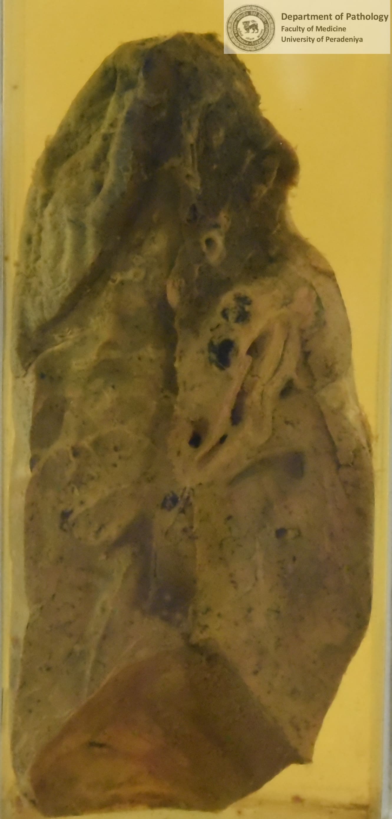 D.51