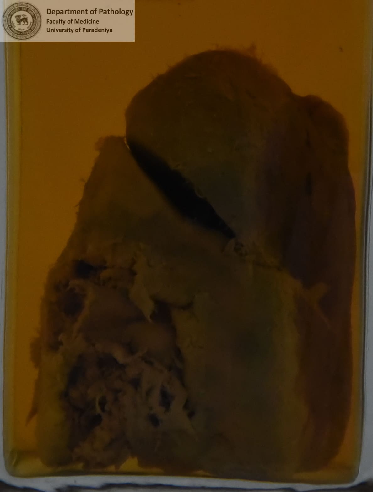 D.52