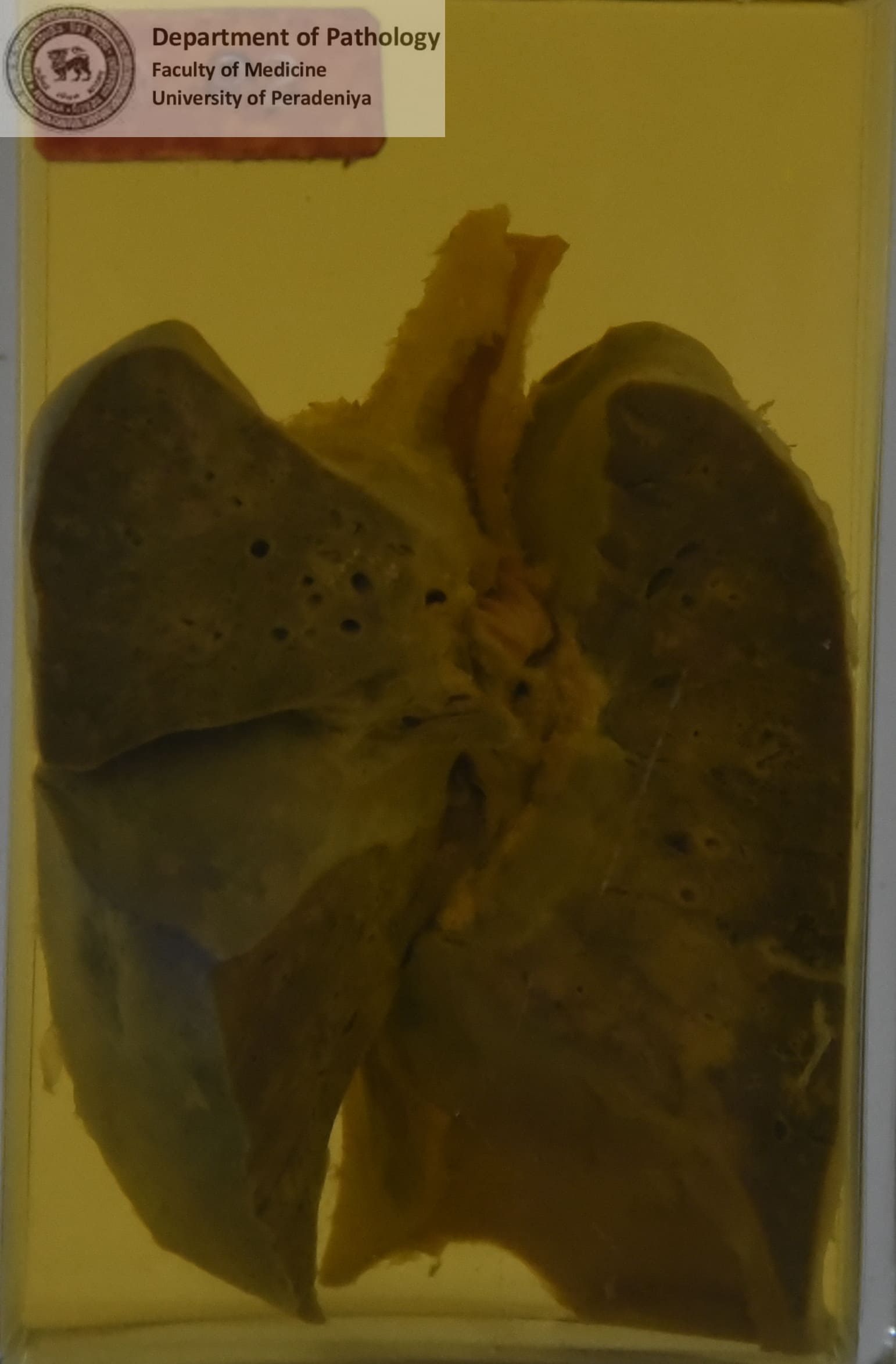 D.92