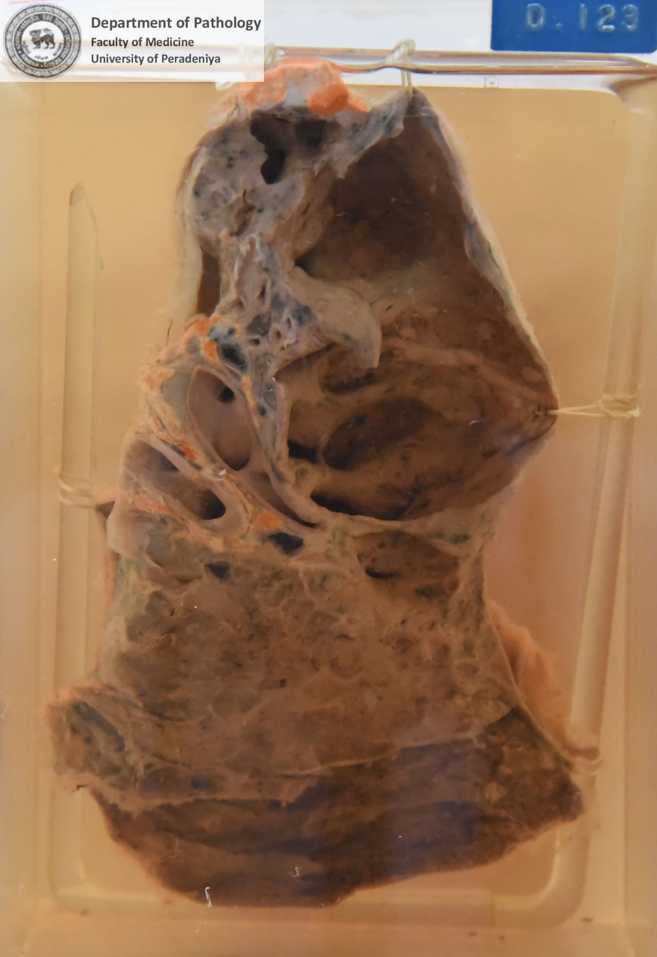 D.123