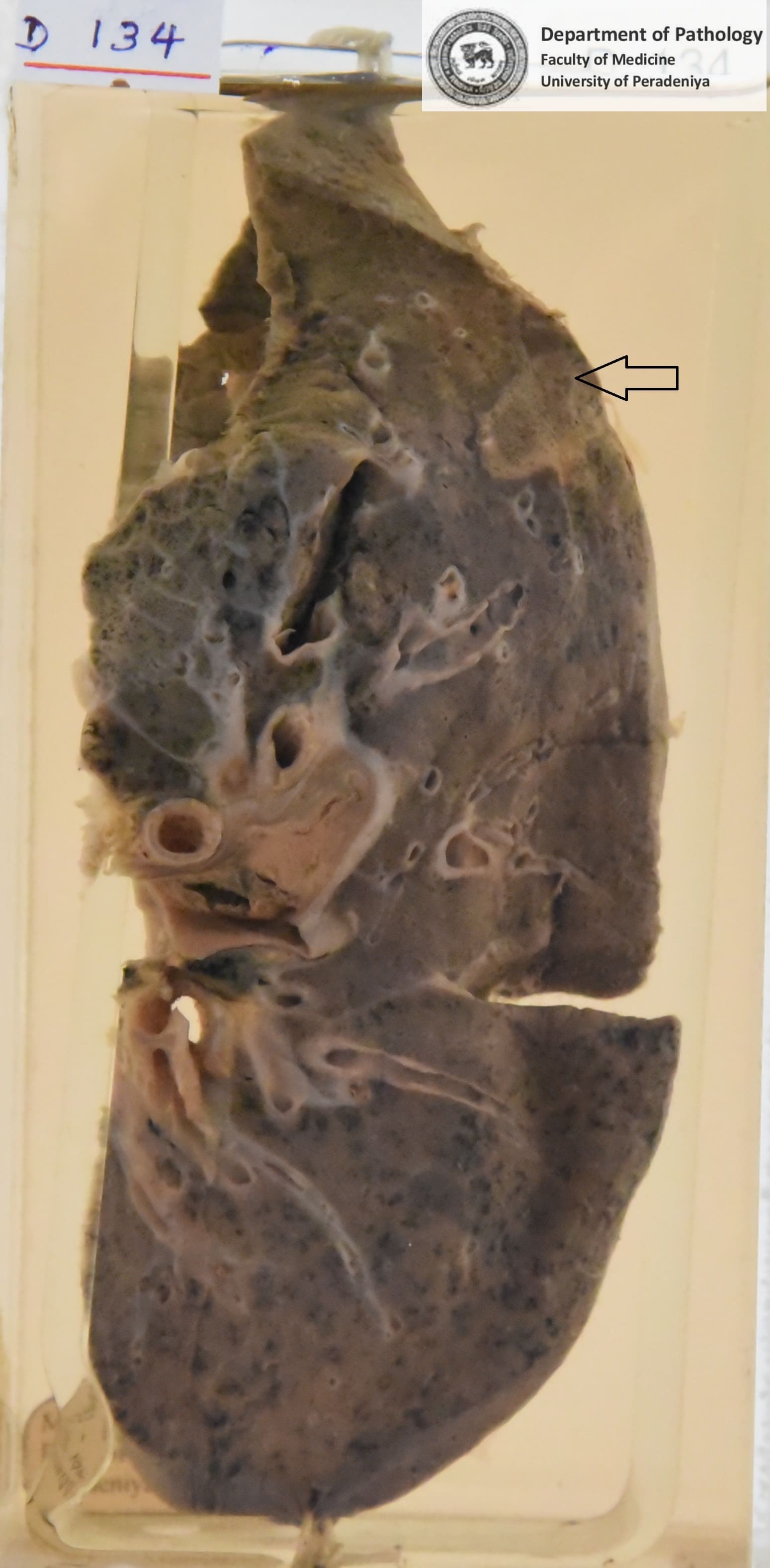 D.134