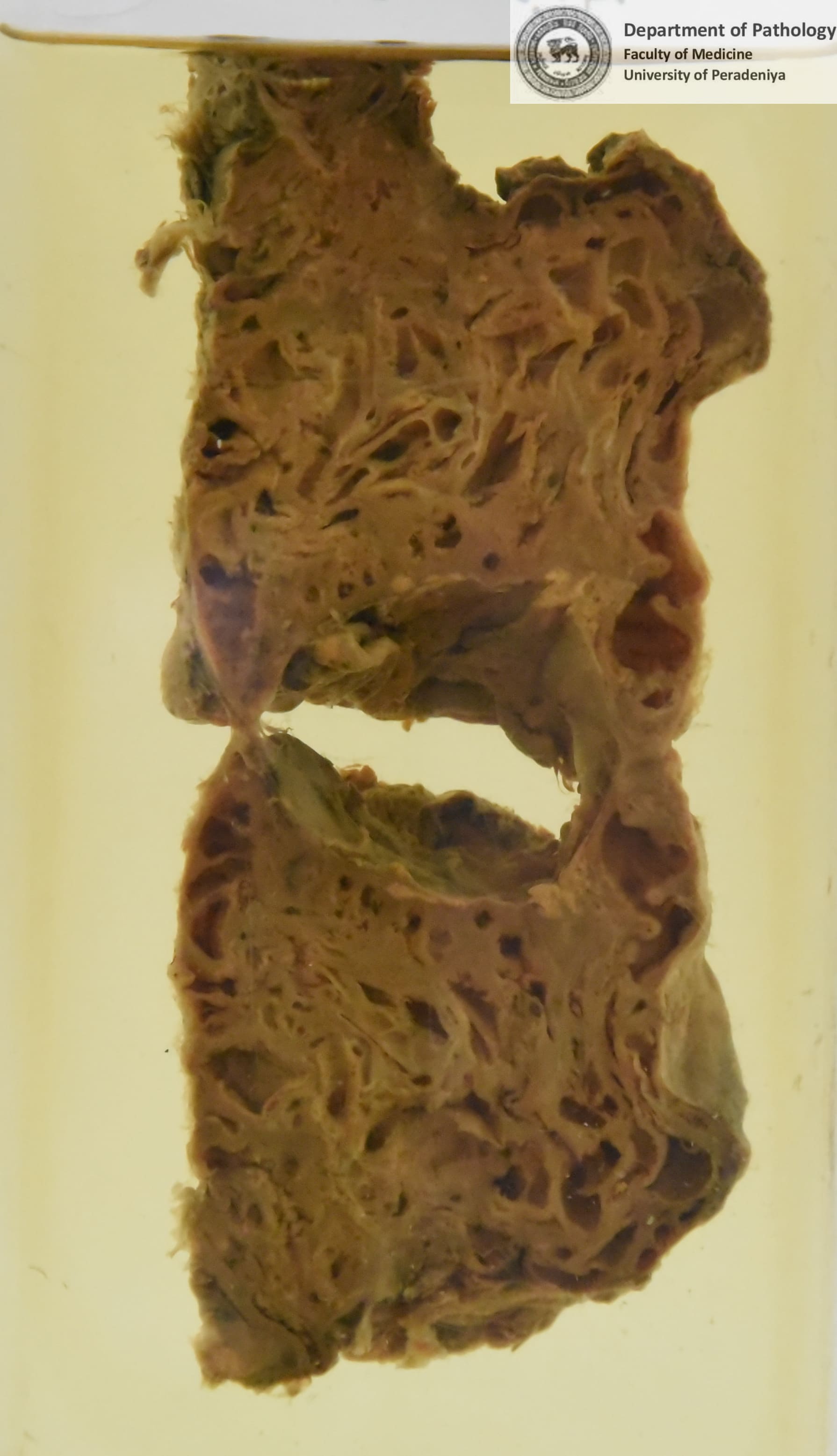 D.159