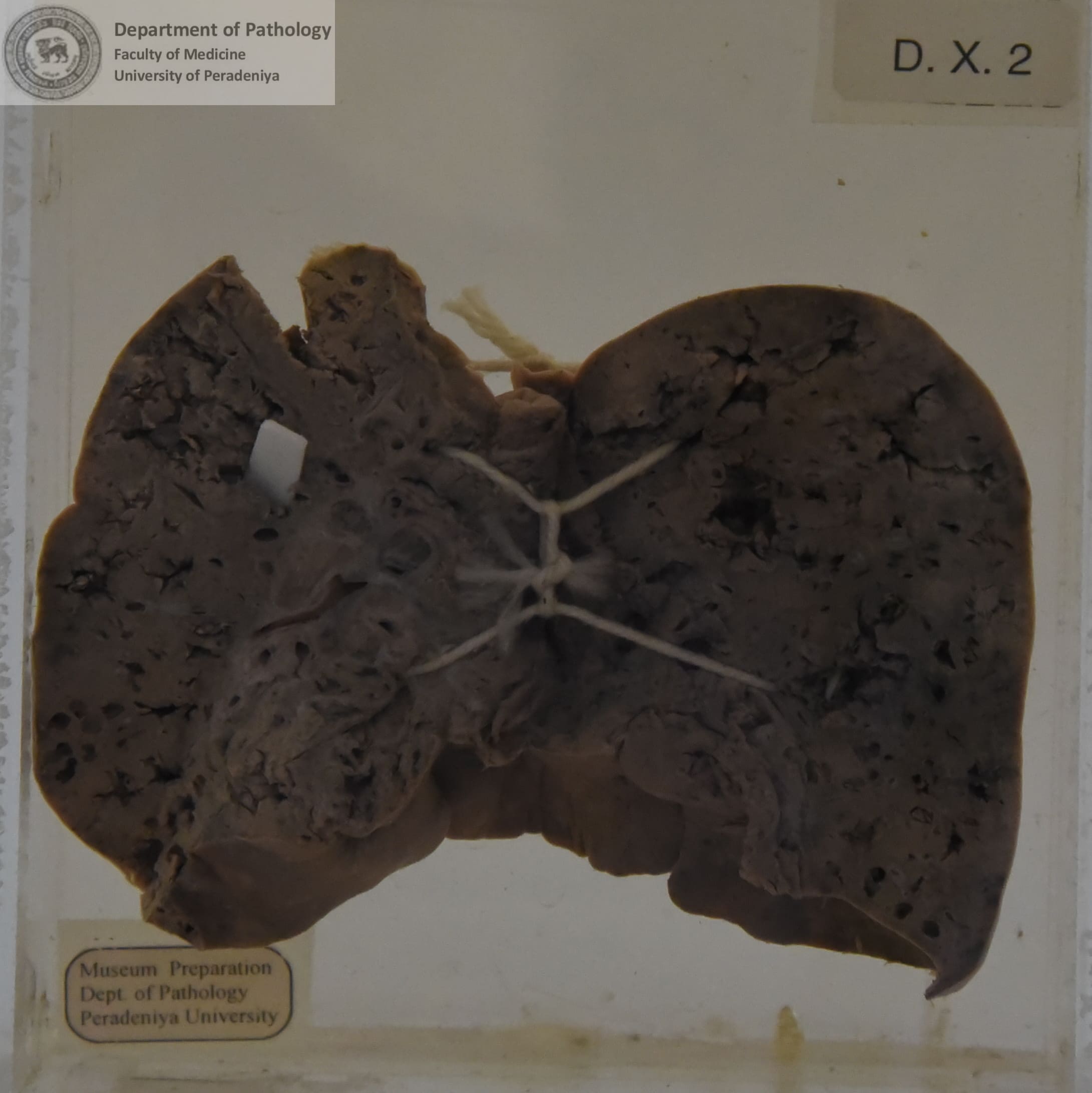DX.2