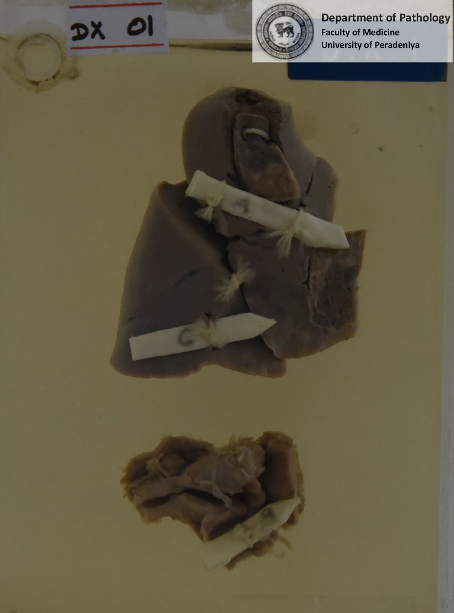 DX.1