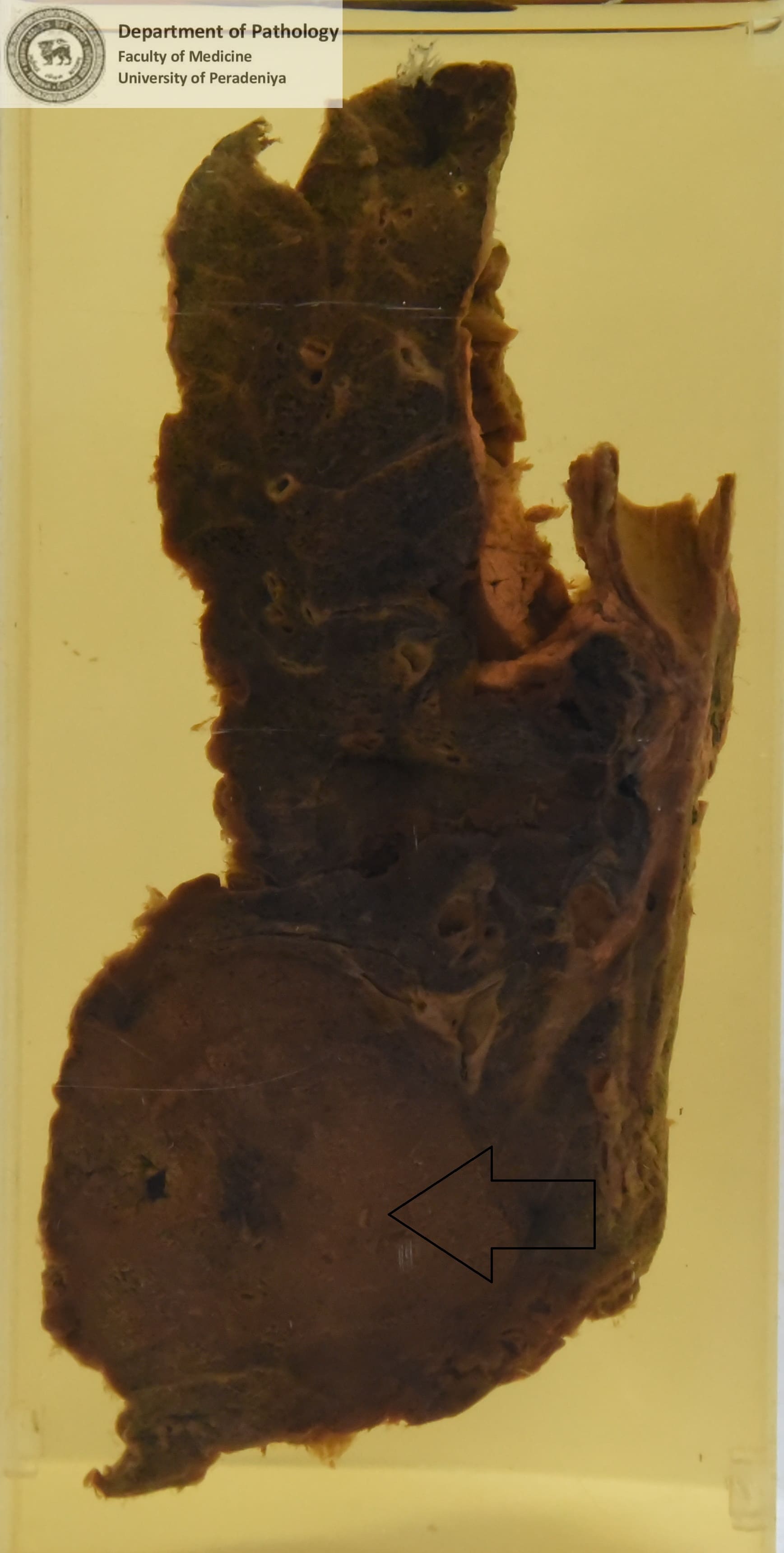 DX.8