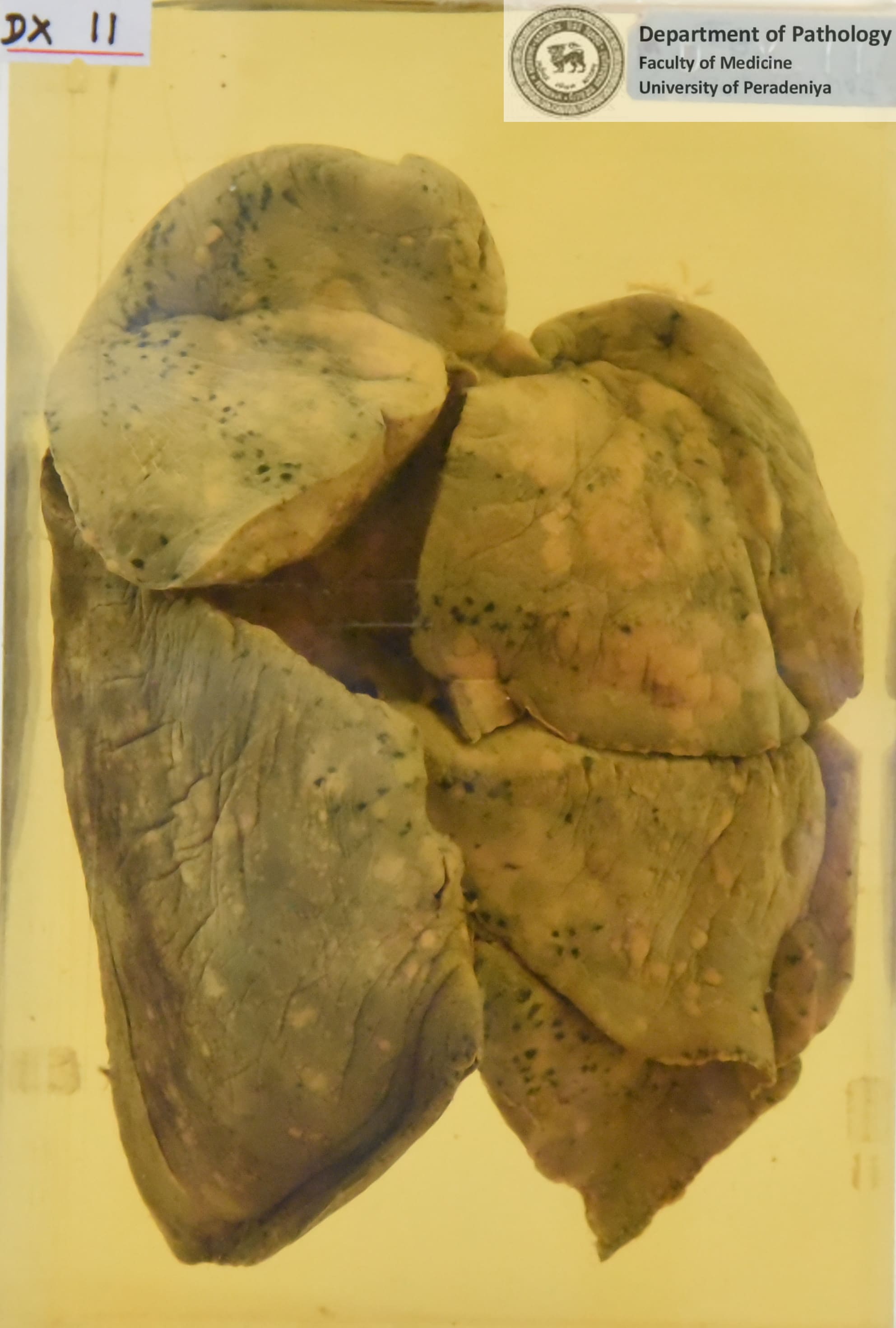 DX.11