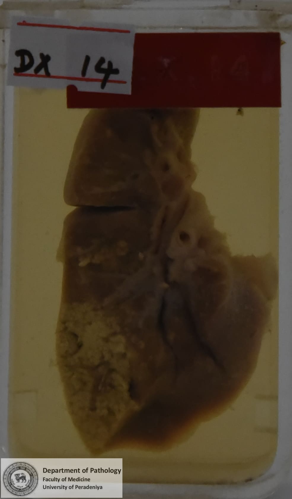 DX.14