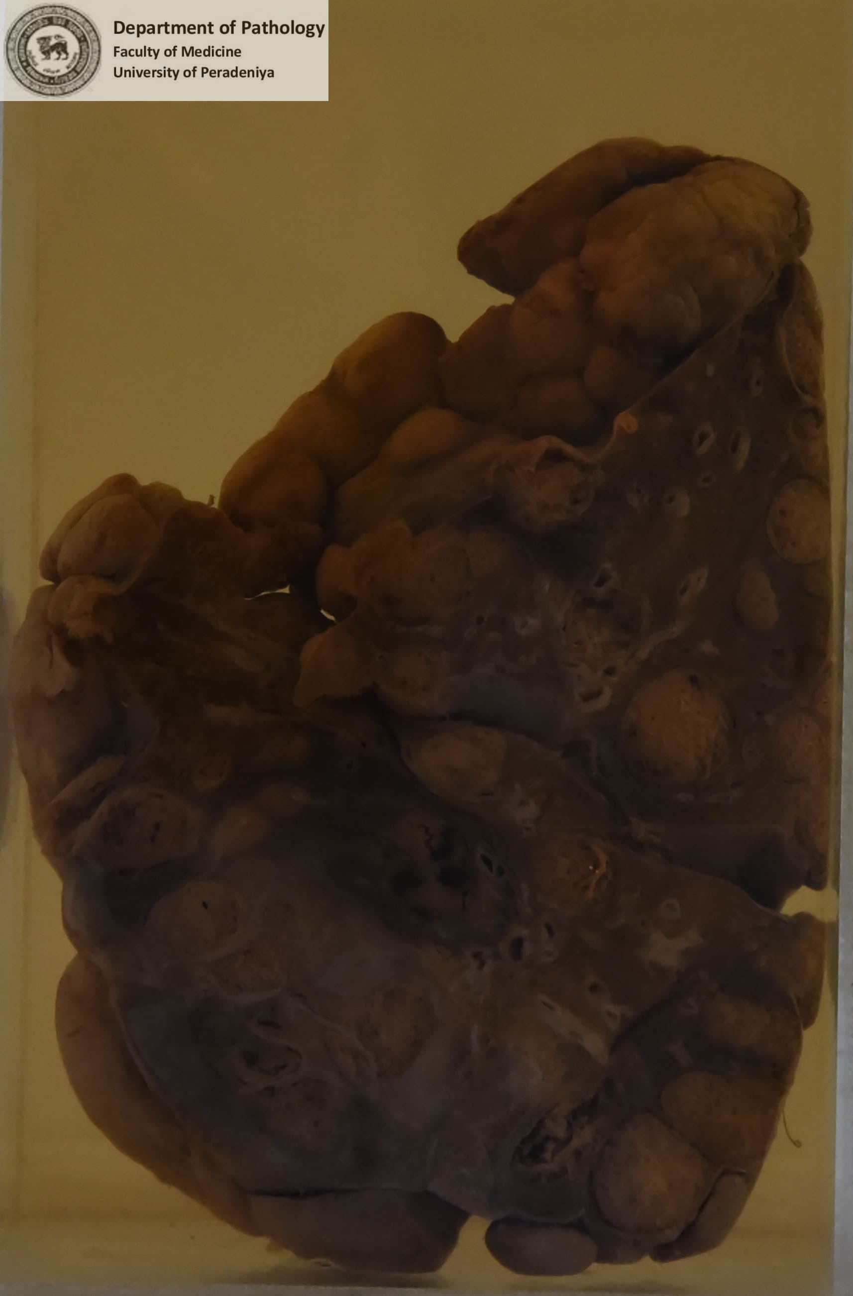 DX.15