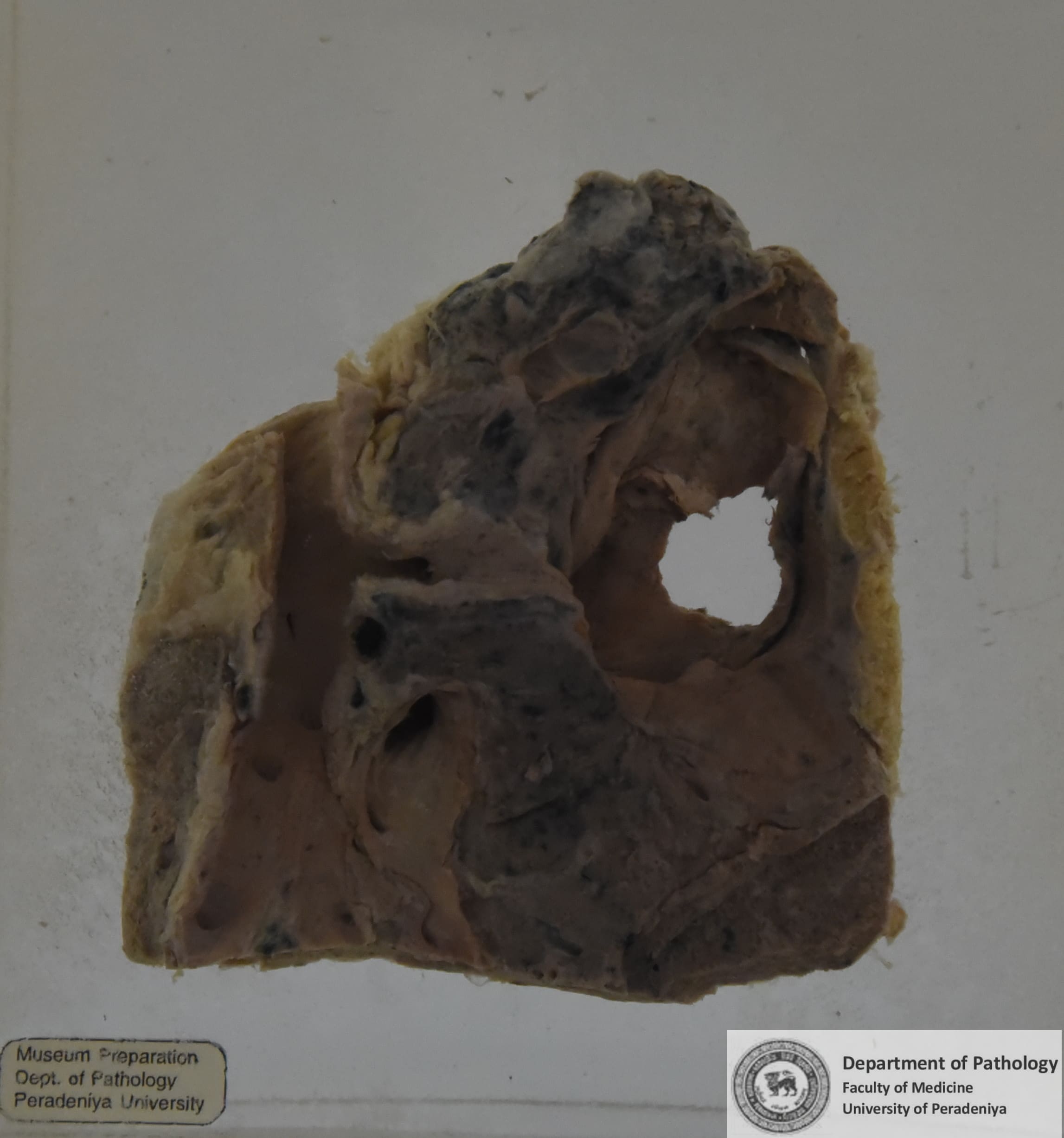 DX.16