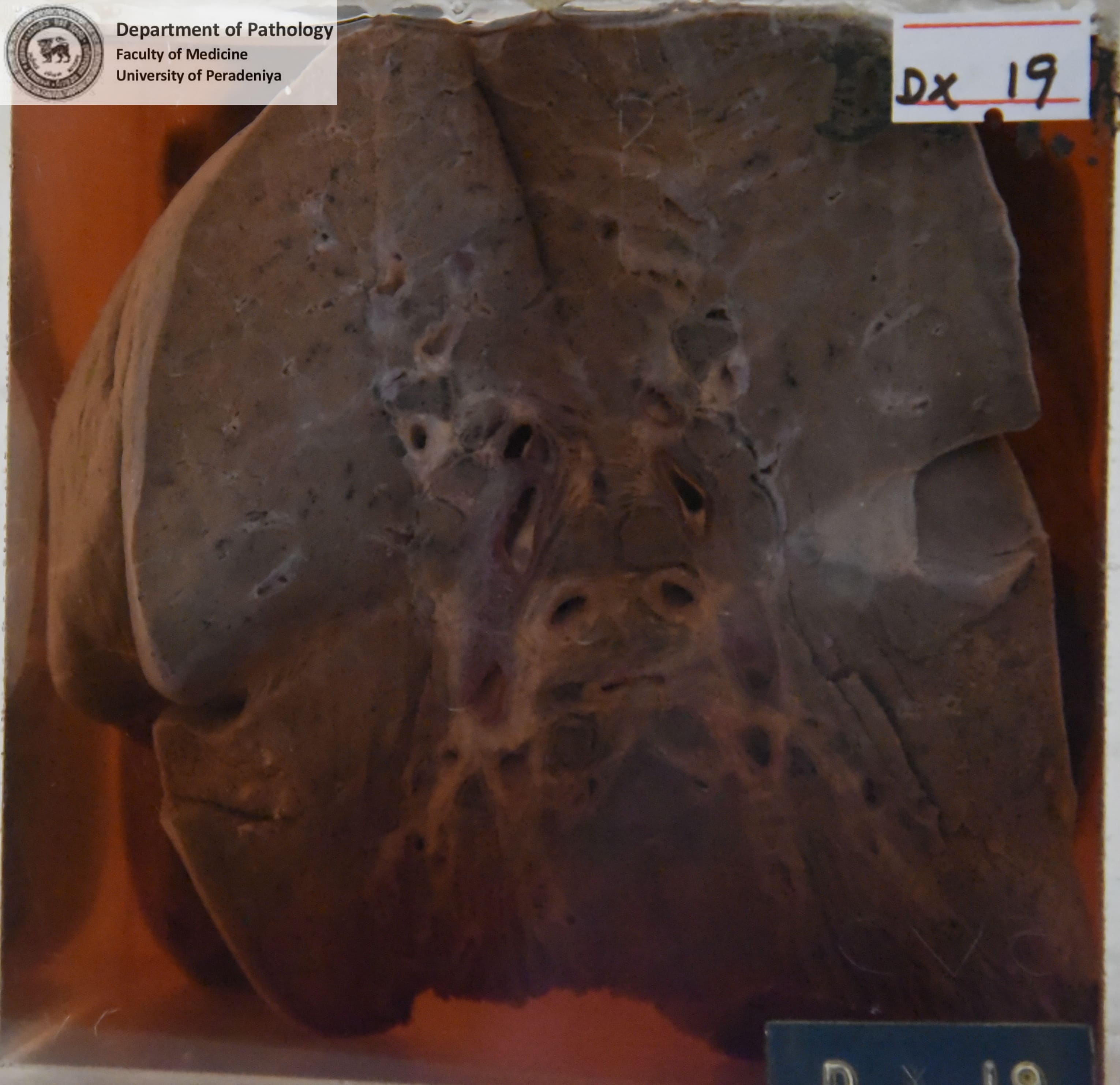 DX.19