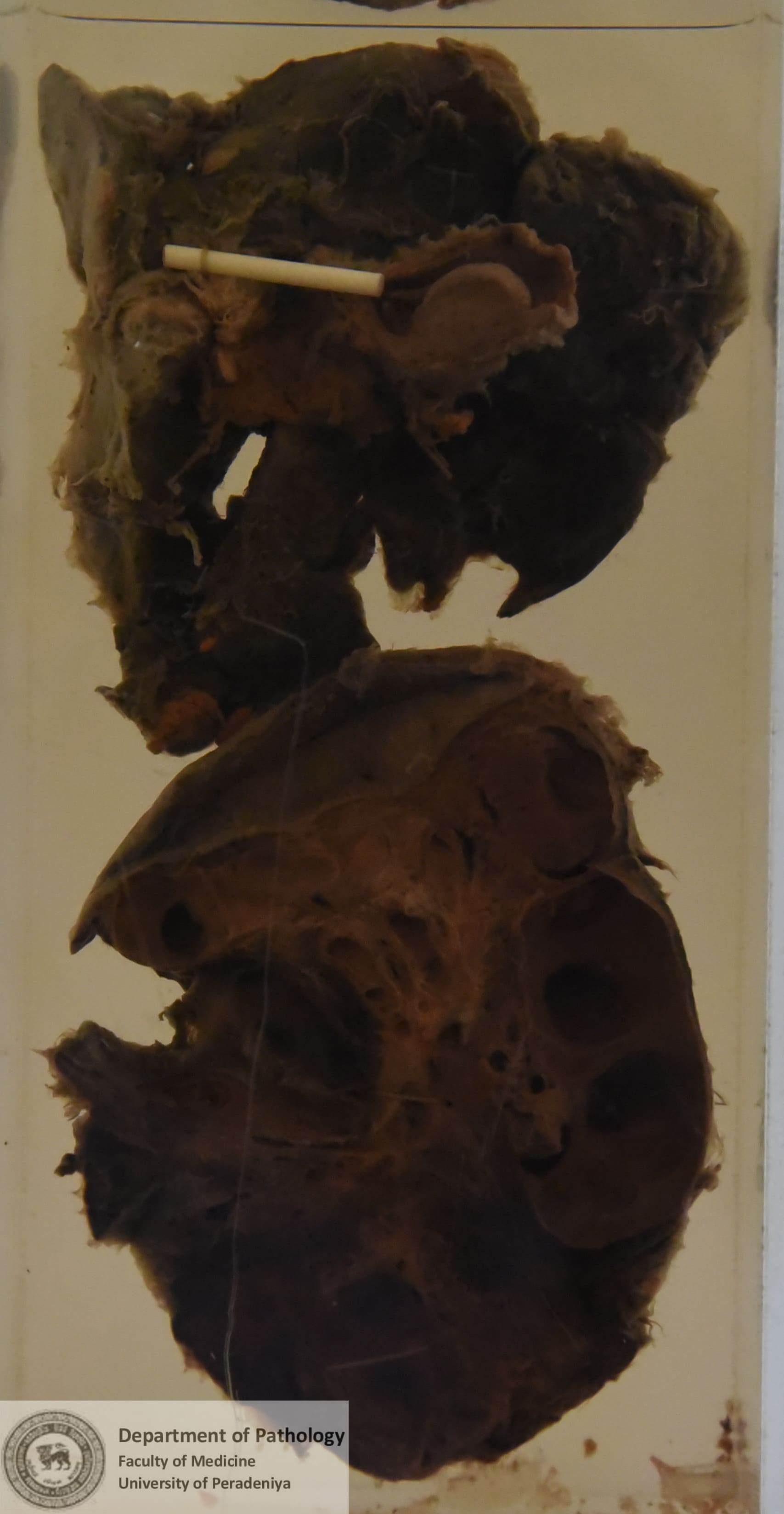 DX.20