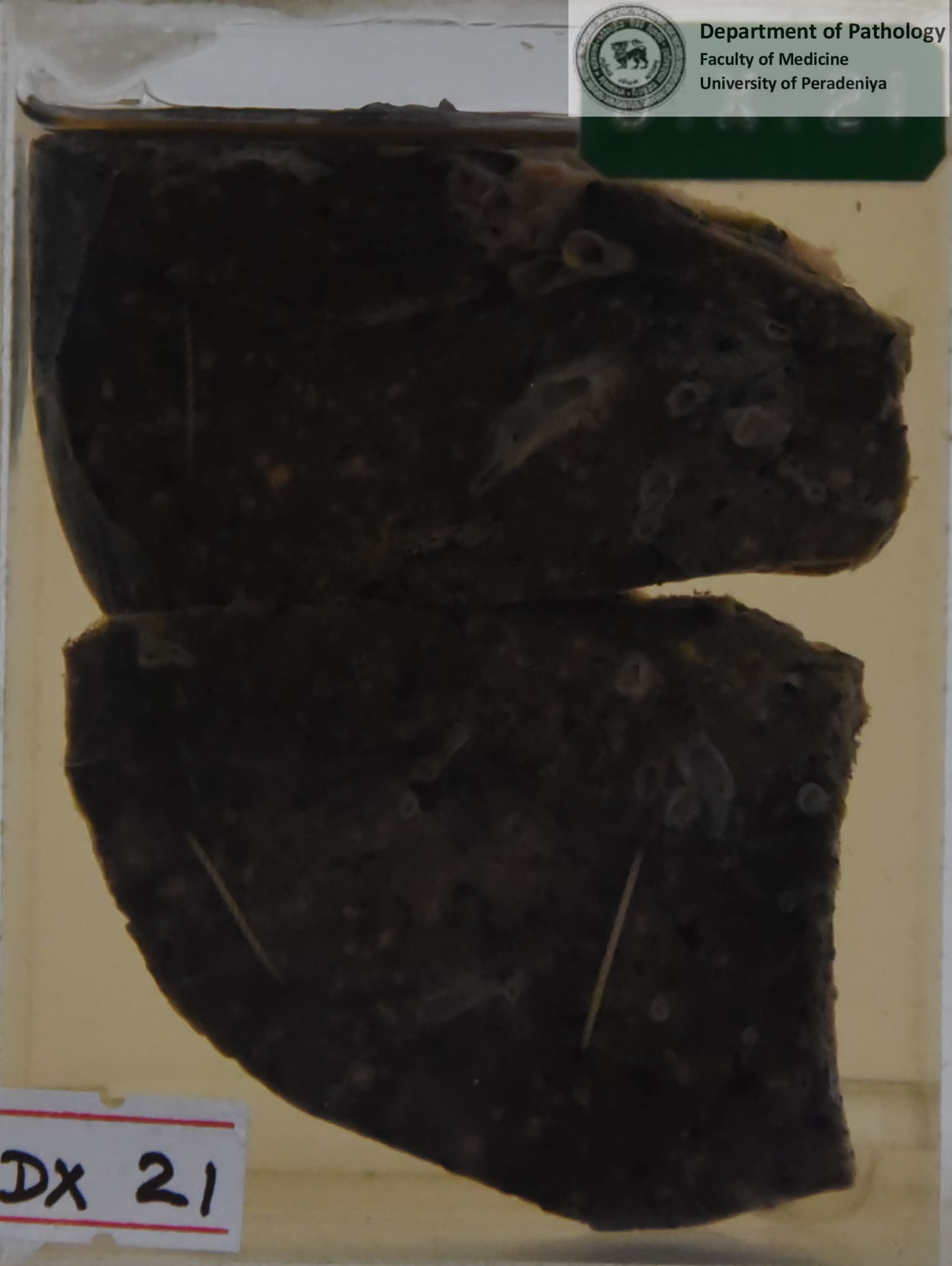 DX.21