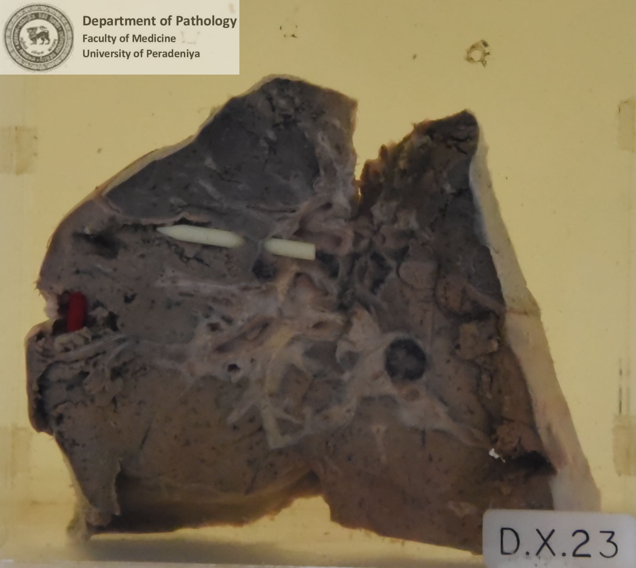 DX.23