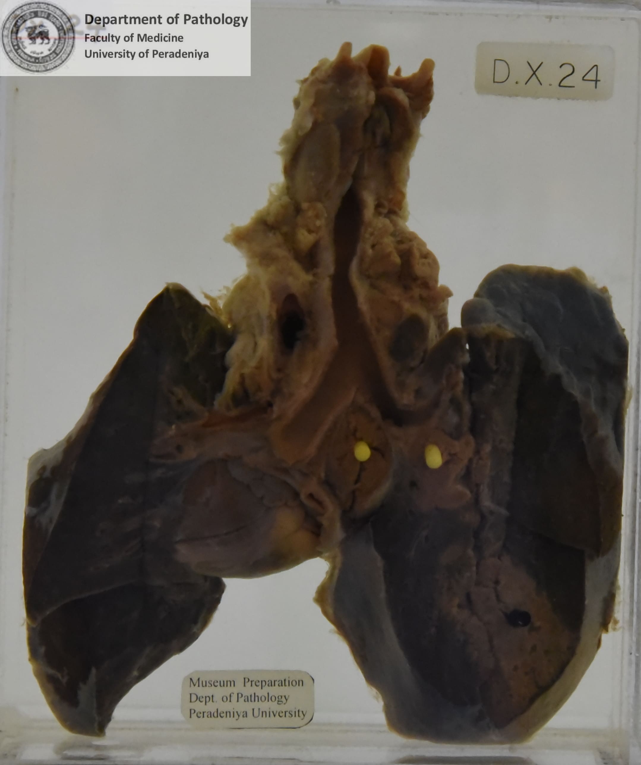 DX.24