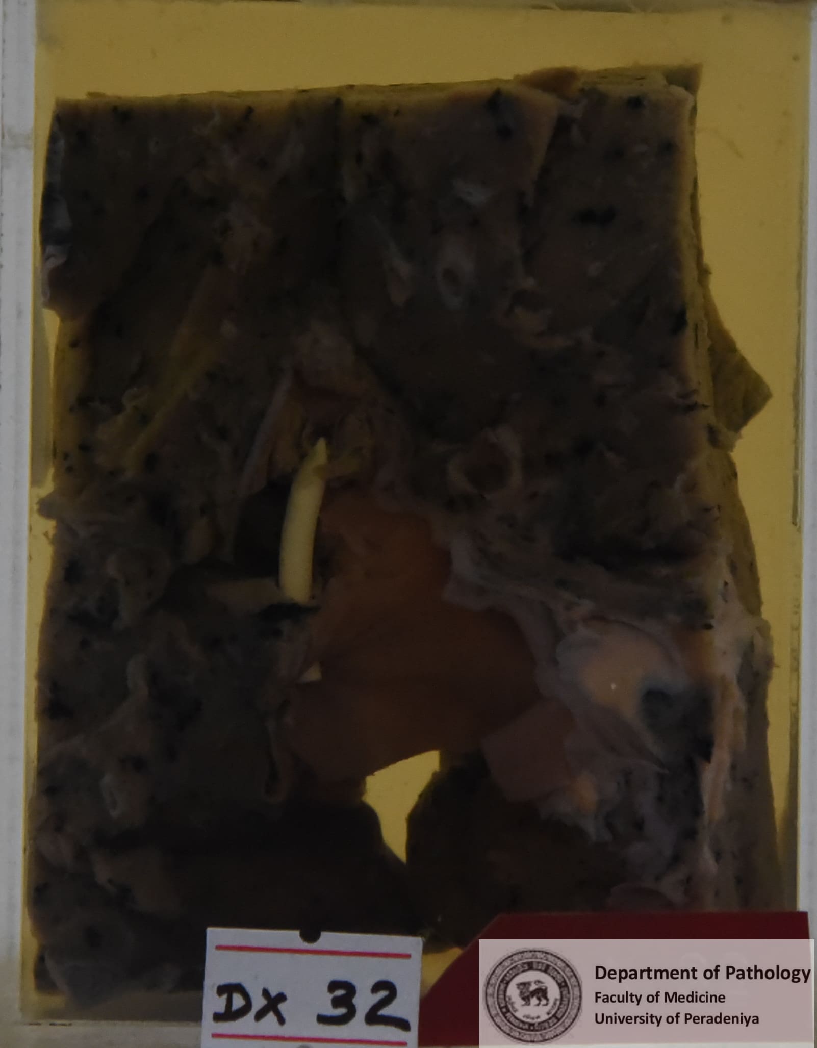 DX.32