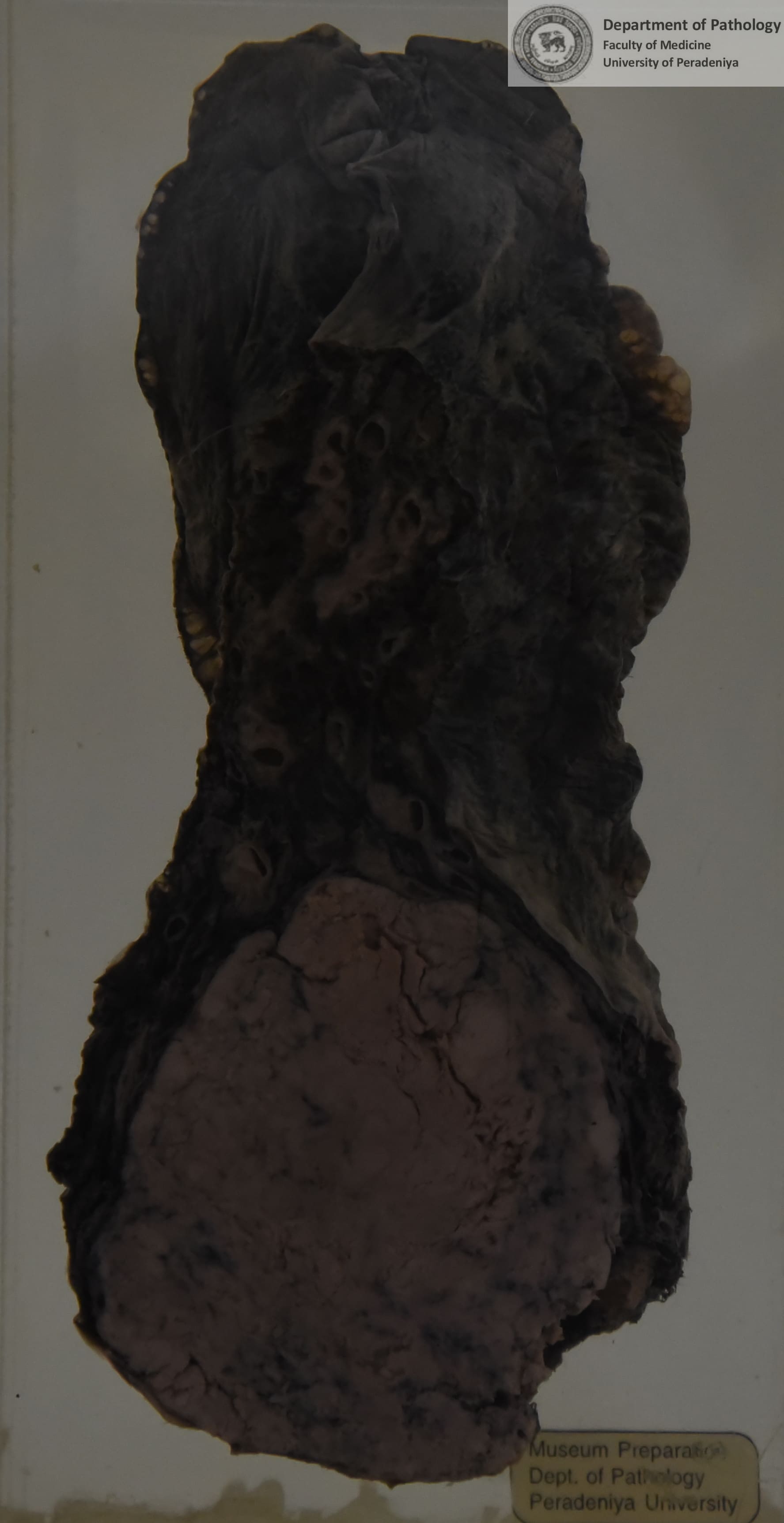 DX.35